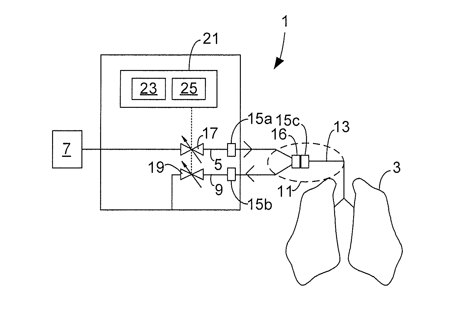 Valve controlled high frequency oscillatory ventilation