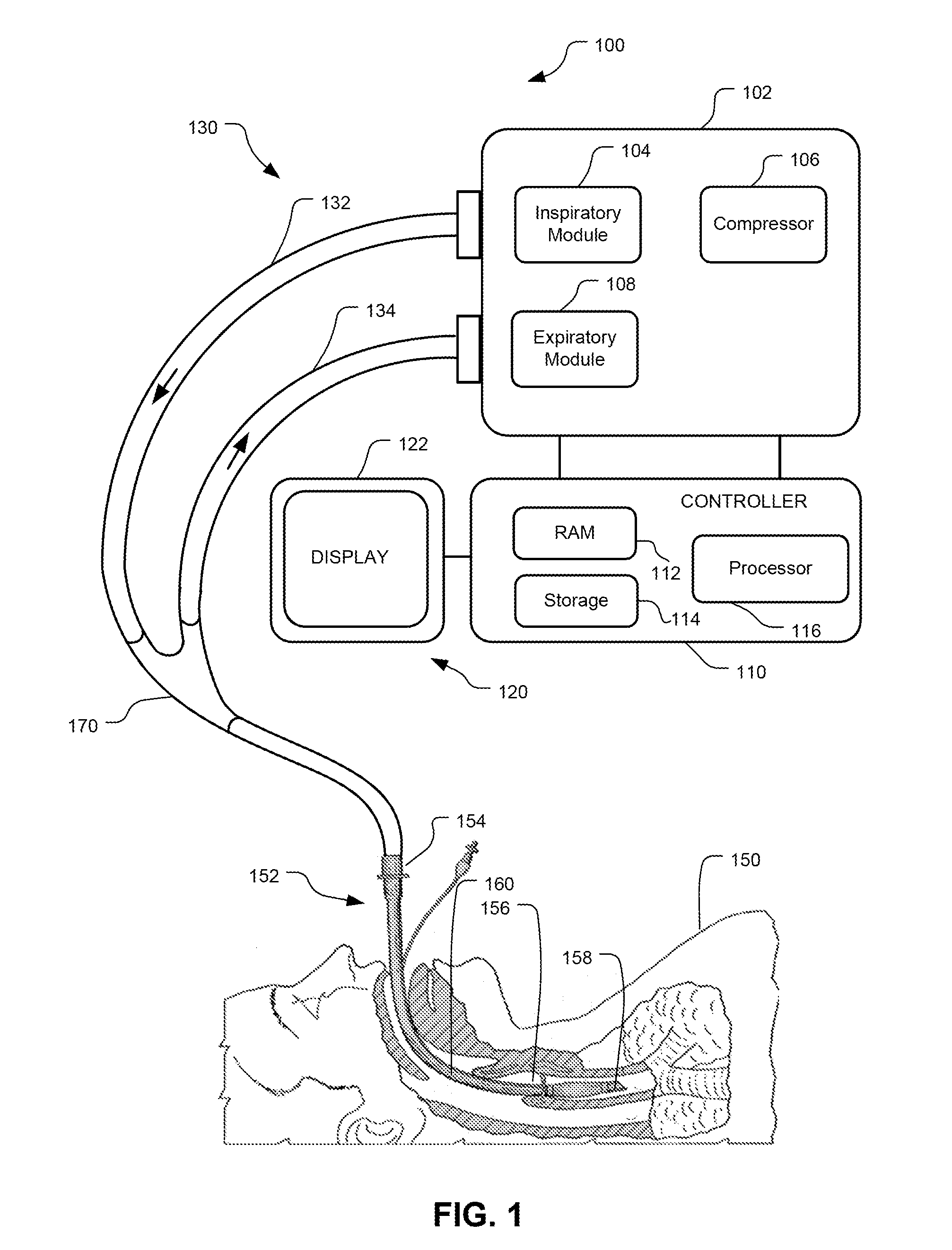 Method And System For Delivering A Multi-Breath, Low Flow Recruitment Maneuver