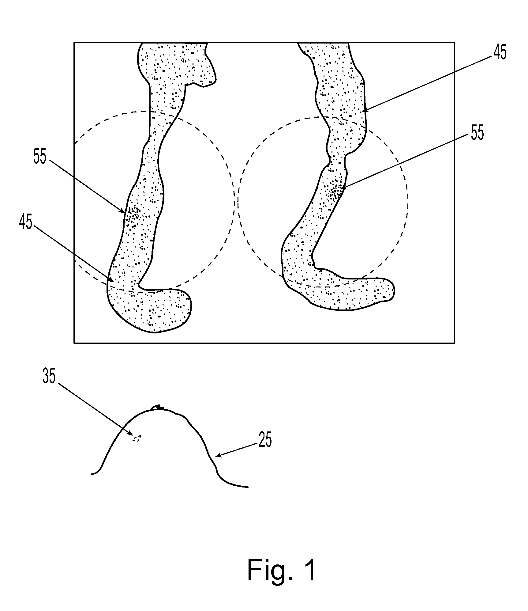 System and apparatus for rapid stereotactic breast biopsy analysis