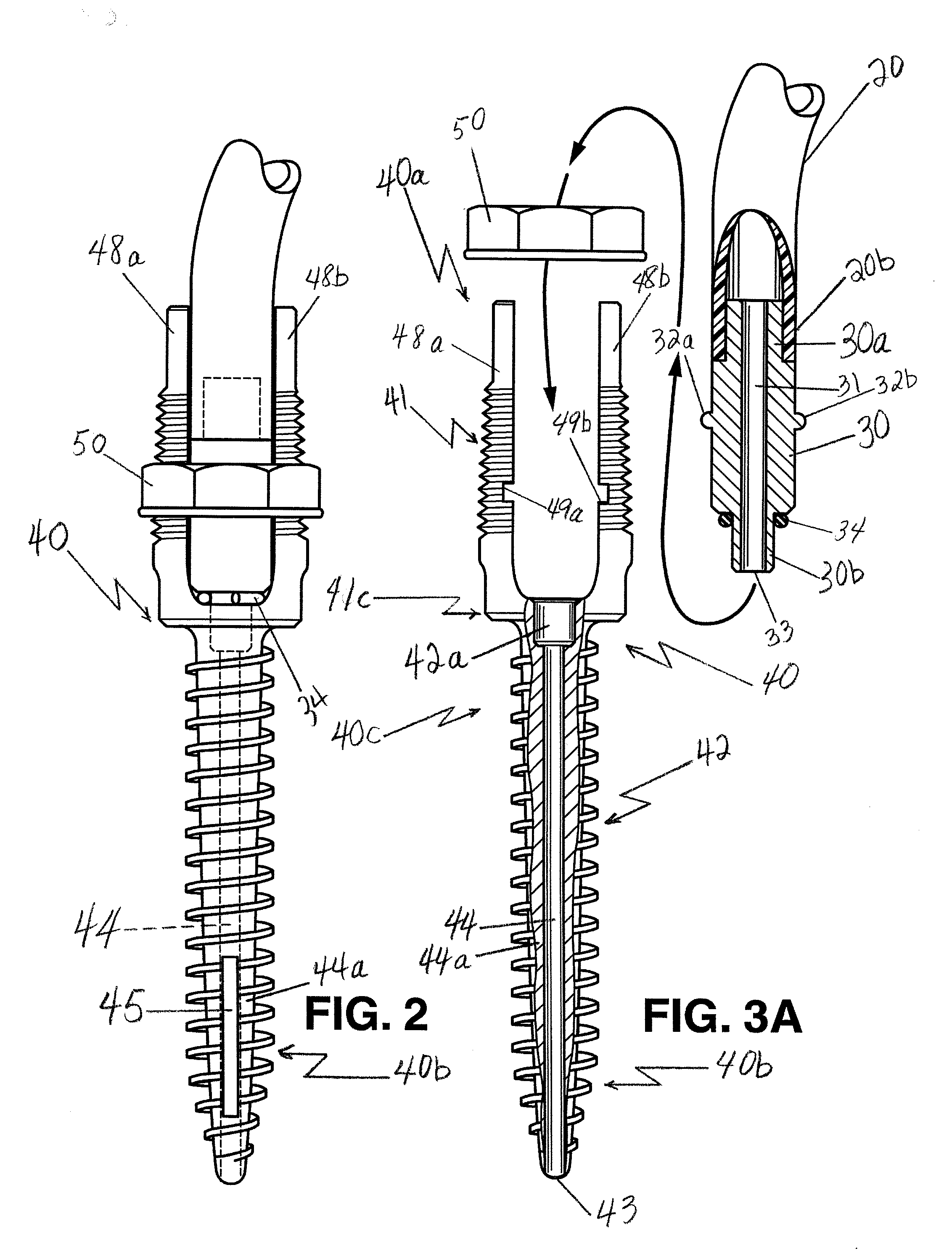 Method and apparatus for anchoring bone screws and injecting many types of high viscosity materials in areas surrounding bone