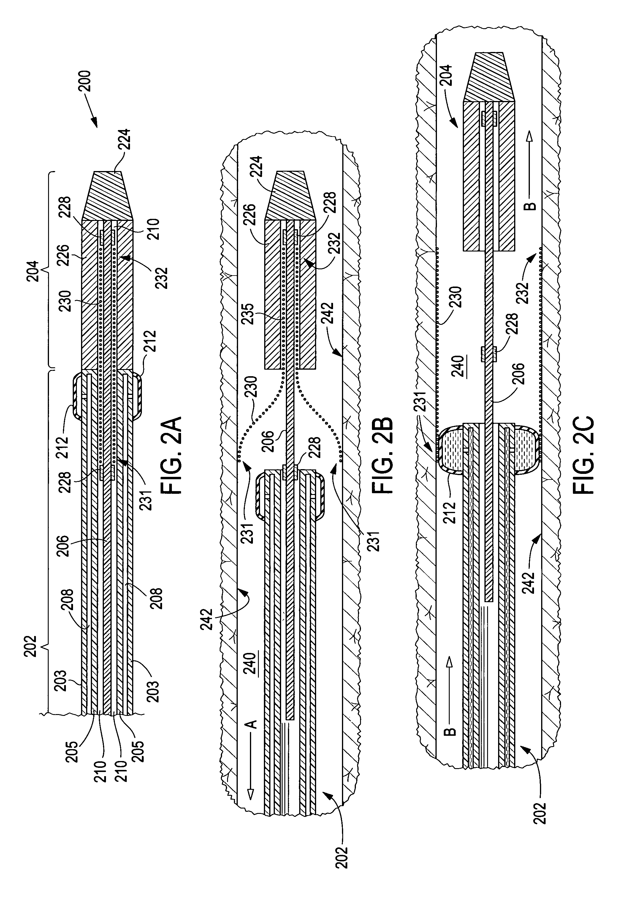 Apparatus and method for deployment of an endoluminal device