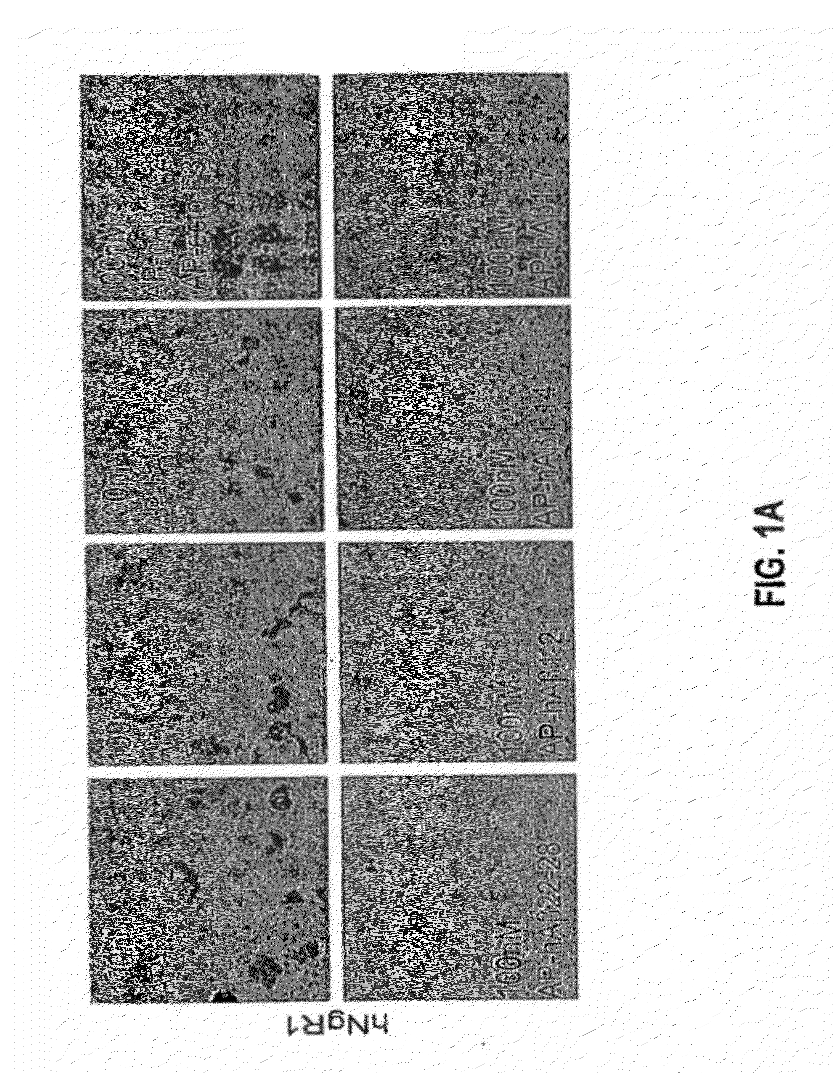 Methods Relating to Peripheral Administration of Nogo Receptor Polypeptides