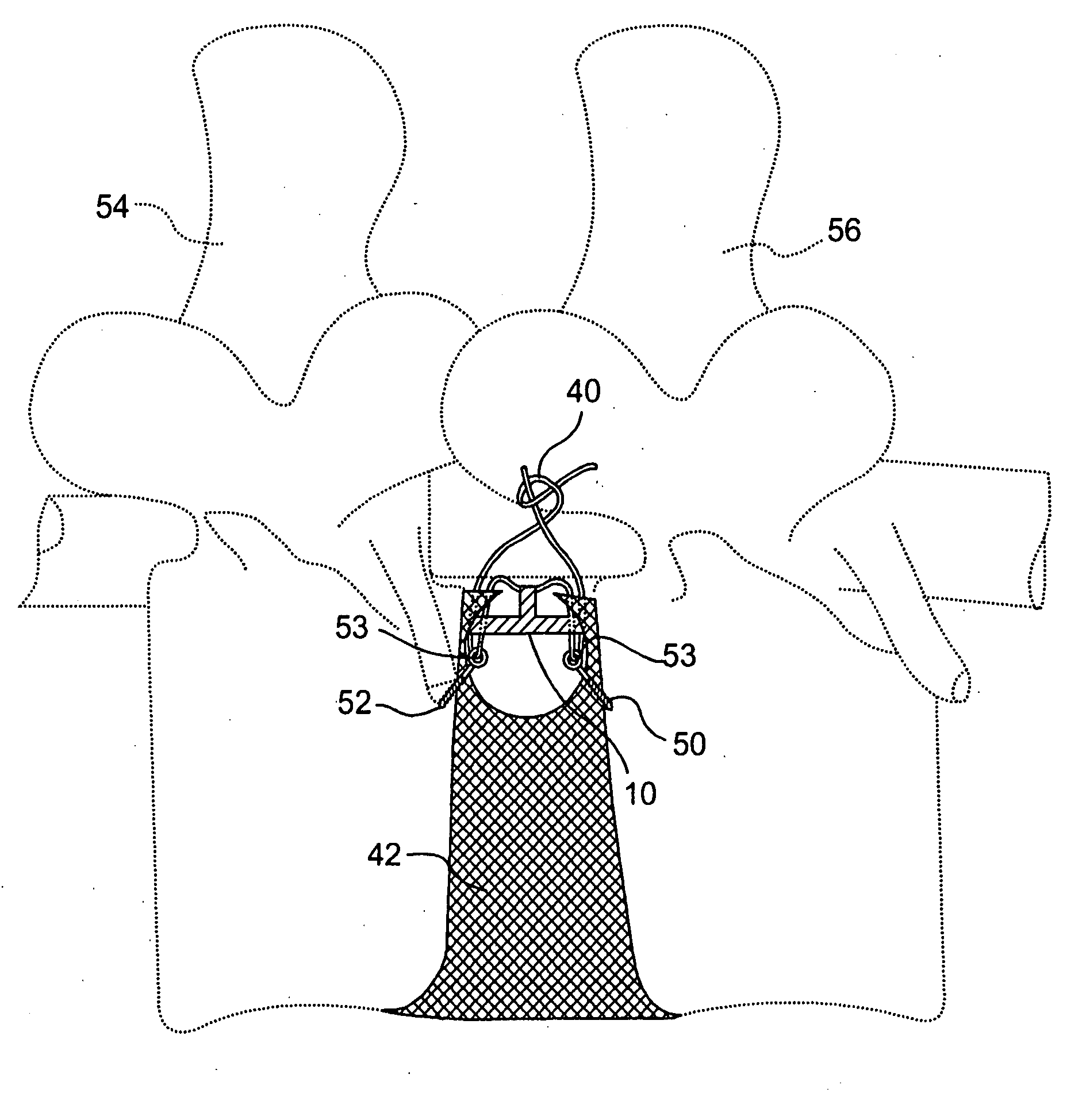 Spinal disc annulus repair device