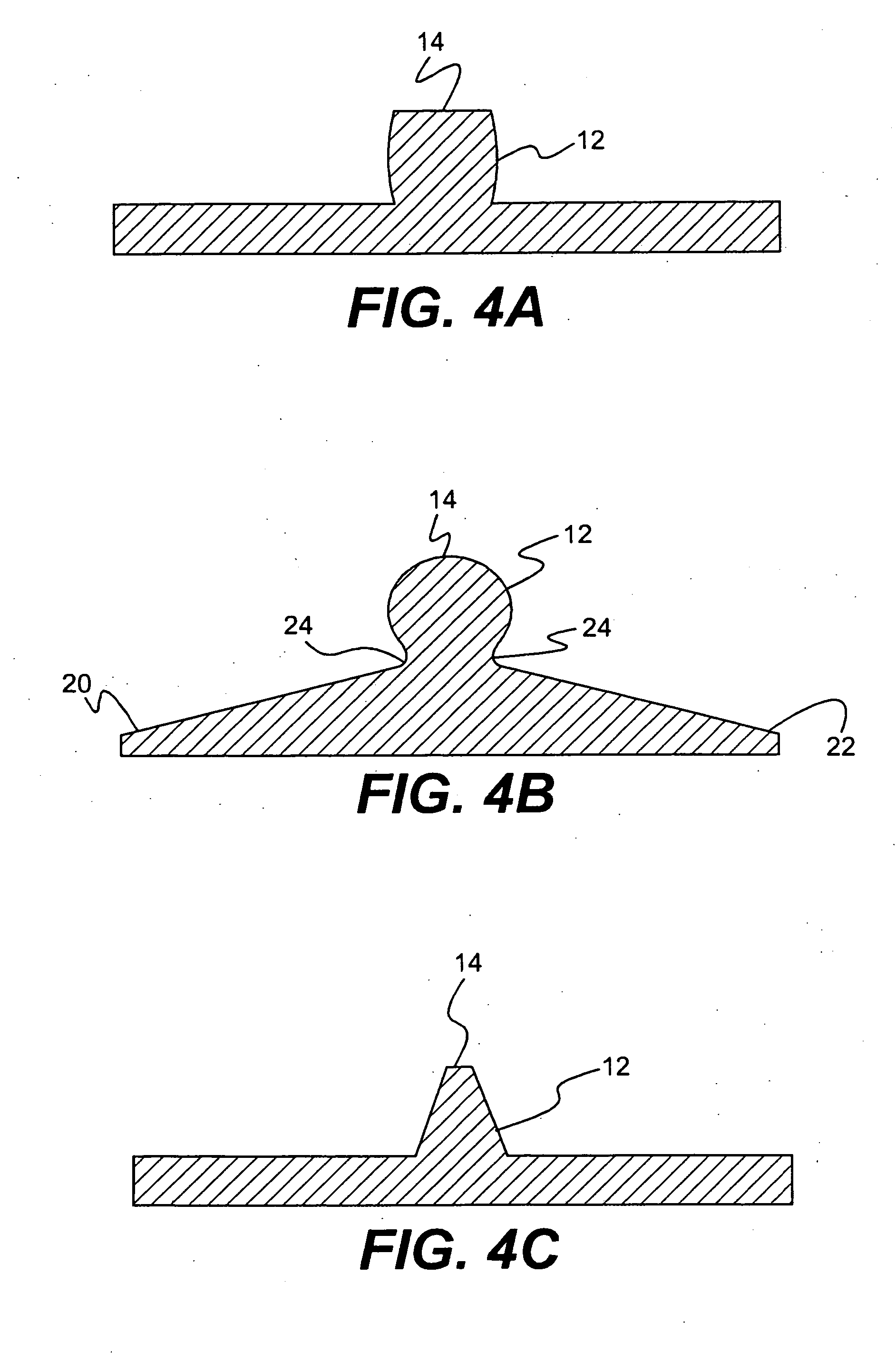 Spinal disc annulus repair device