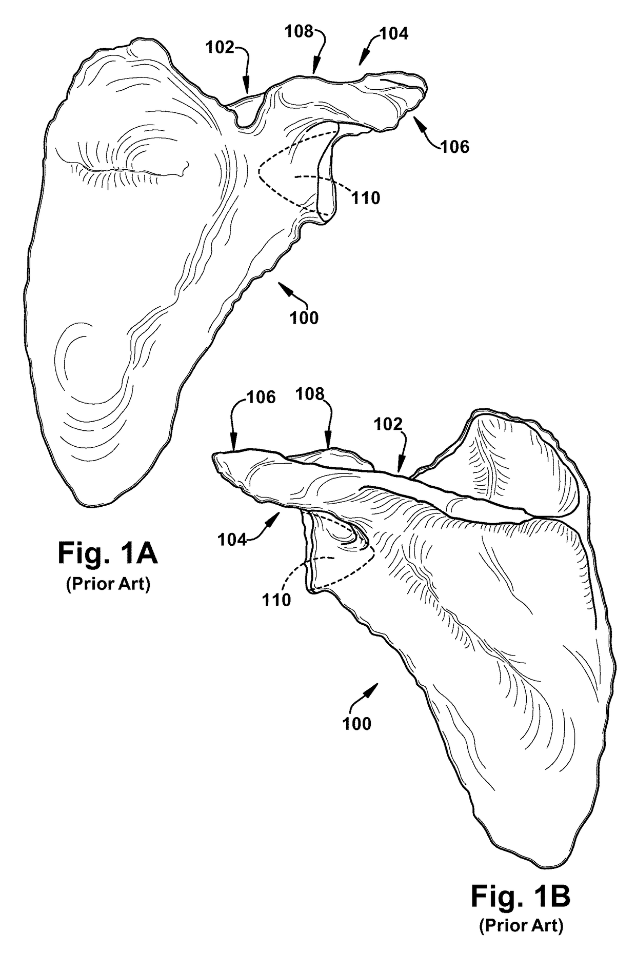 System of preoperative planning and provision of patient-specific surgical aids