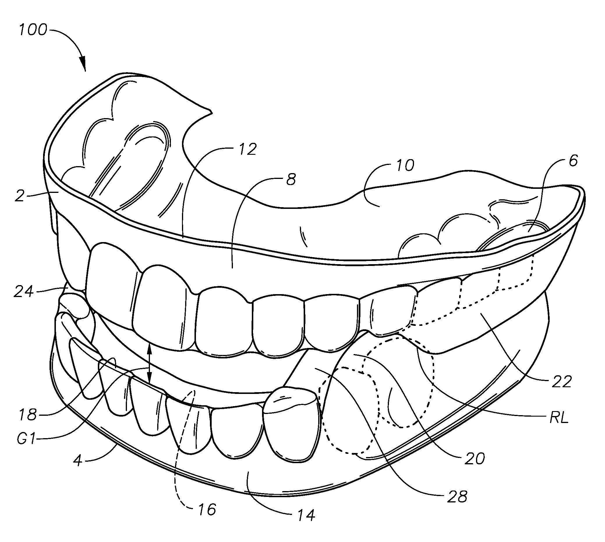 Oral devices