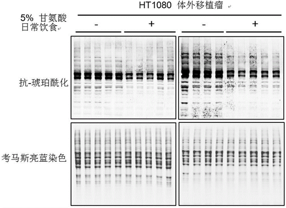 Application of glycine and derivative thereof to preparation of medicine for treating IDH (IsocitrateDehydrogenase) and FH (Fumarate Hydratase) gene mutation related tumors
