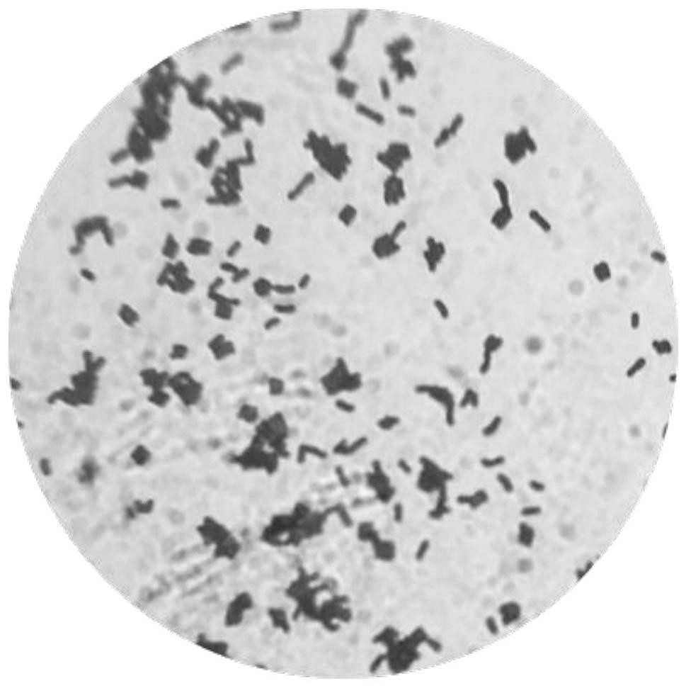 Lactobacillus plantarum NX-1 and application thereof in preparation of hypoglycemic drugs