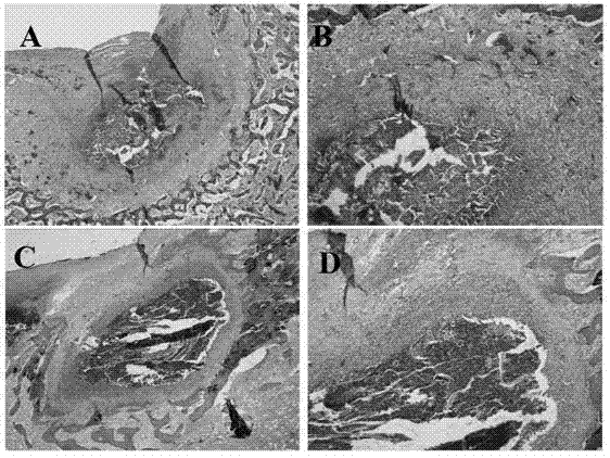 Preparation technology of biphasic bone and cartilage tissue engineering scaffold material