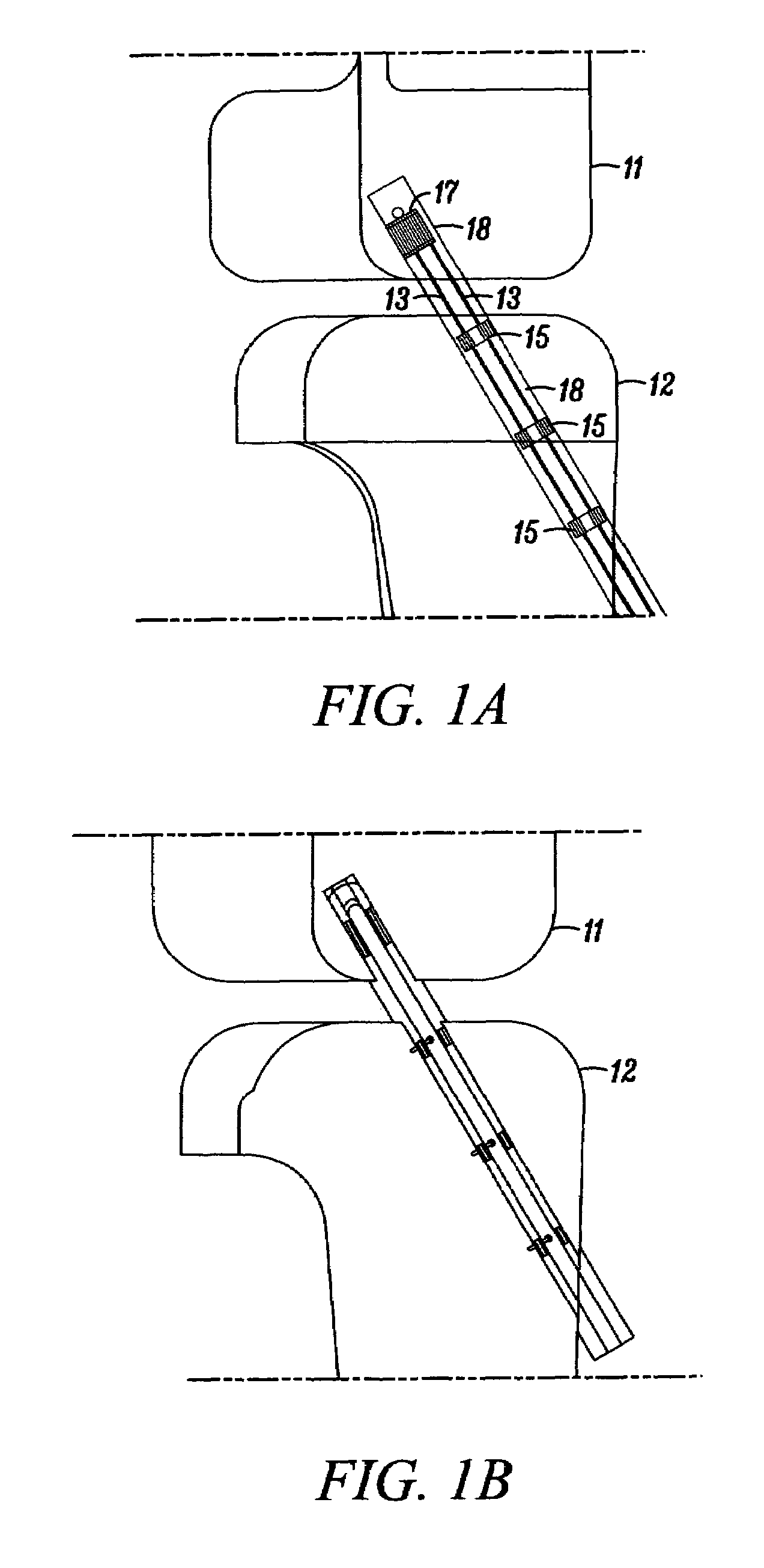 Devices, systems and methods for material fixation