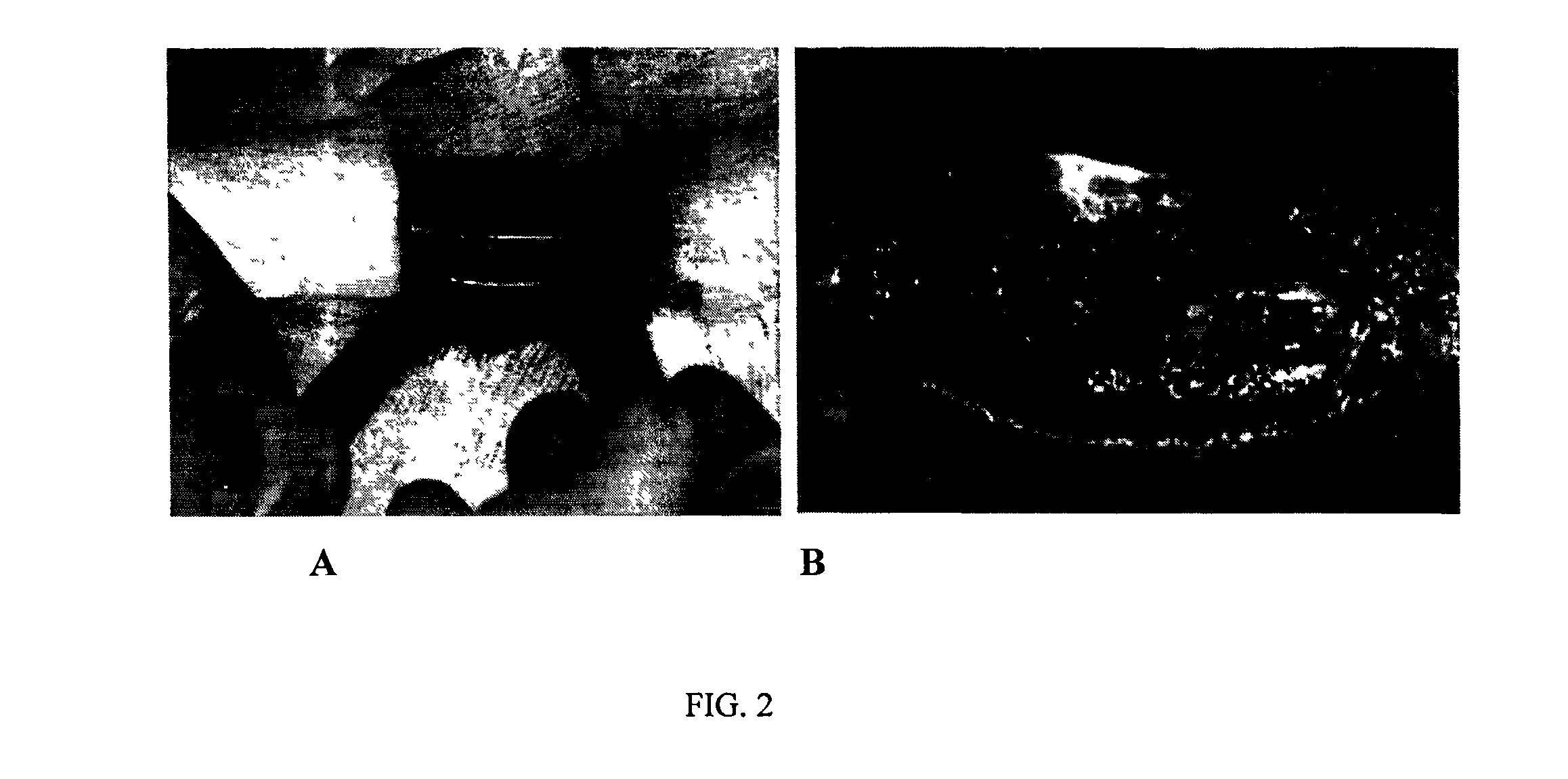 Biocomposite for regeneration of injured tissue and organs, a kit for making the biocomposite, a method of making the biocomposite and a method of treating injuries