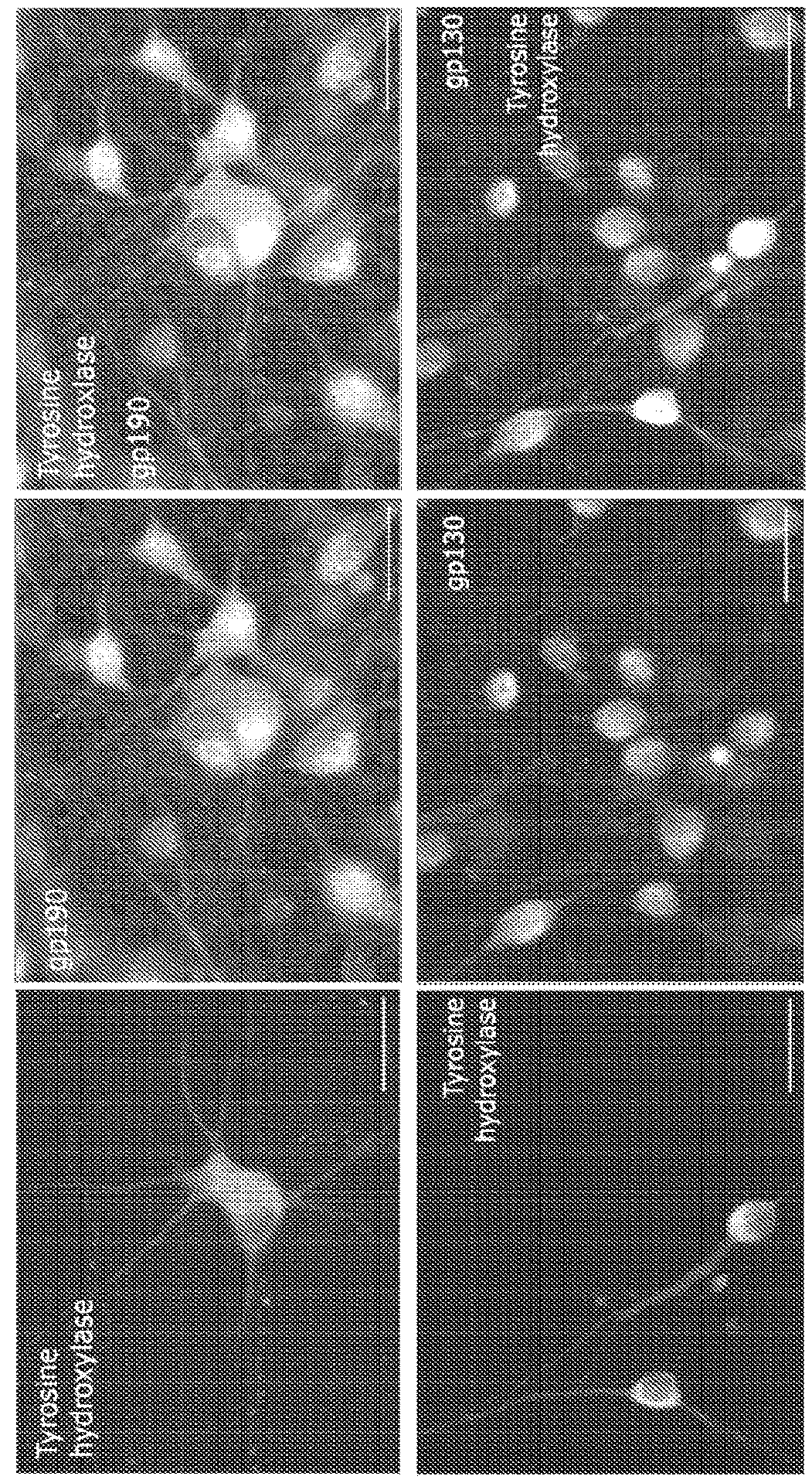 Neurotherapeutic Nanoparticle Compositions Comprising Leukemia Inhibitory Factor
