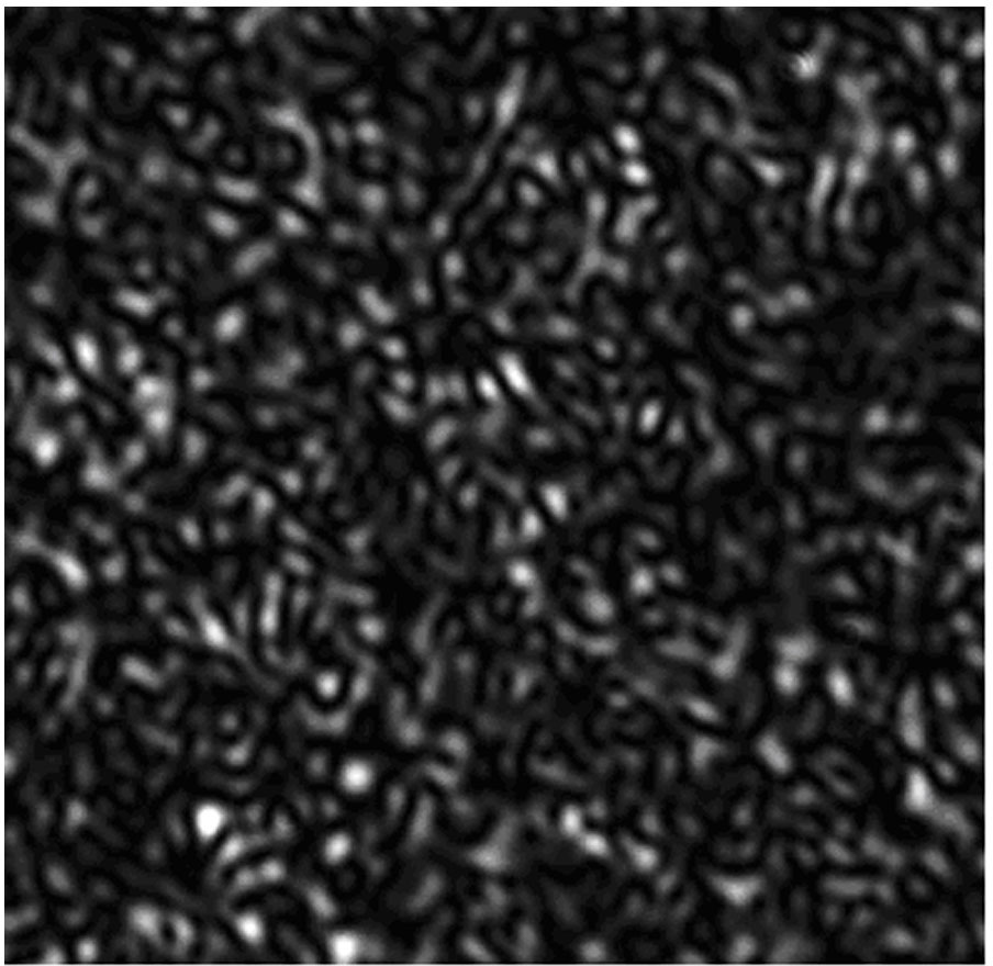 Speckle elimination device based on Mie scattering and Brownian motion