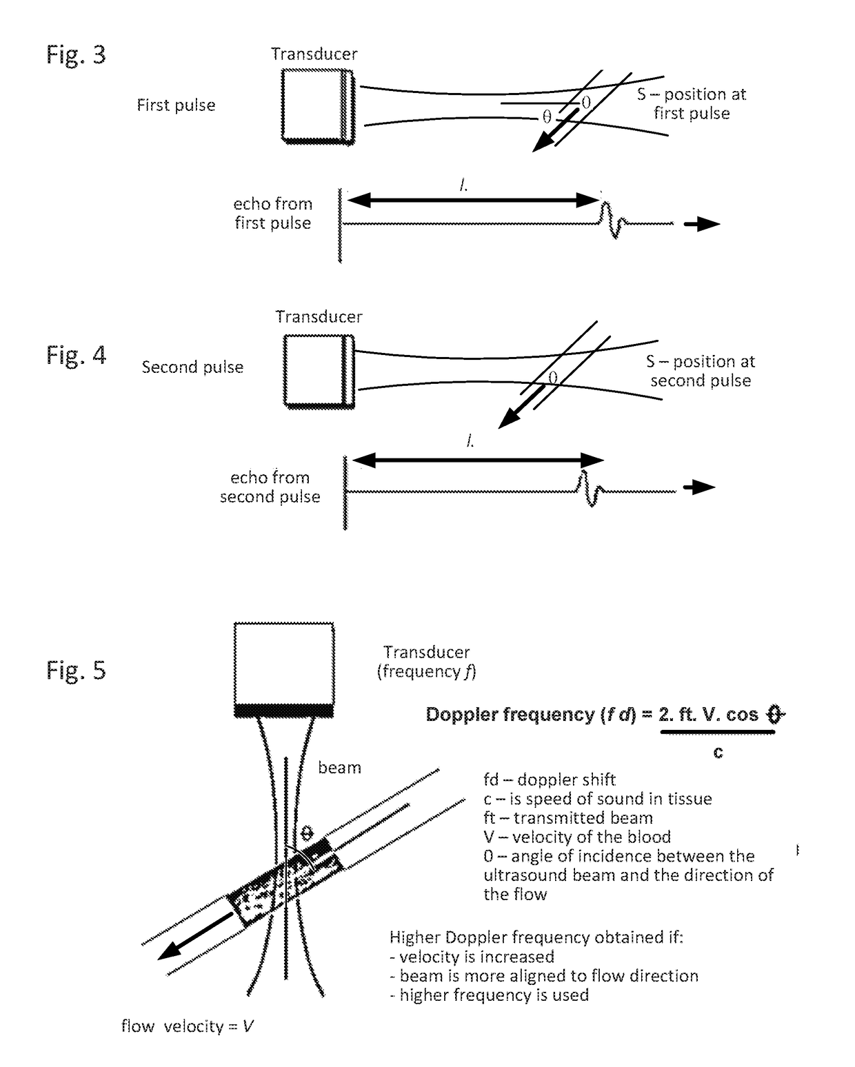 Systems and methods for locating blood vessels in the treatment of rhinitis