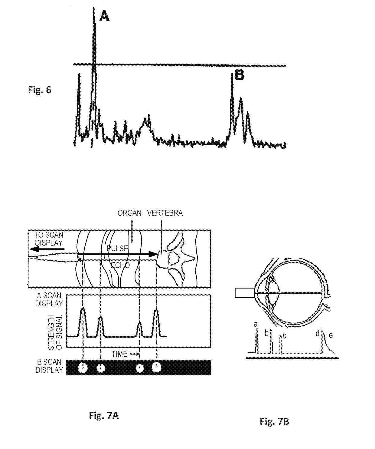 Systems and methods for locating blood vessels in the treatment of rhinitis