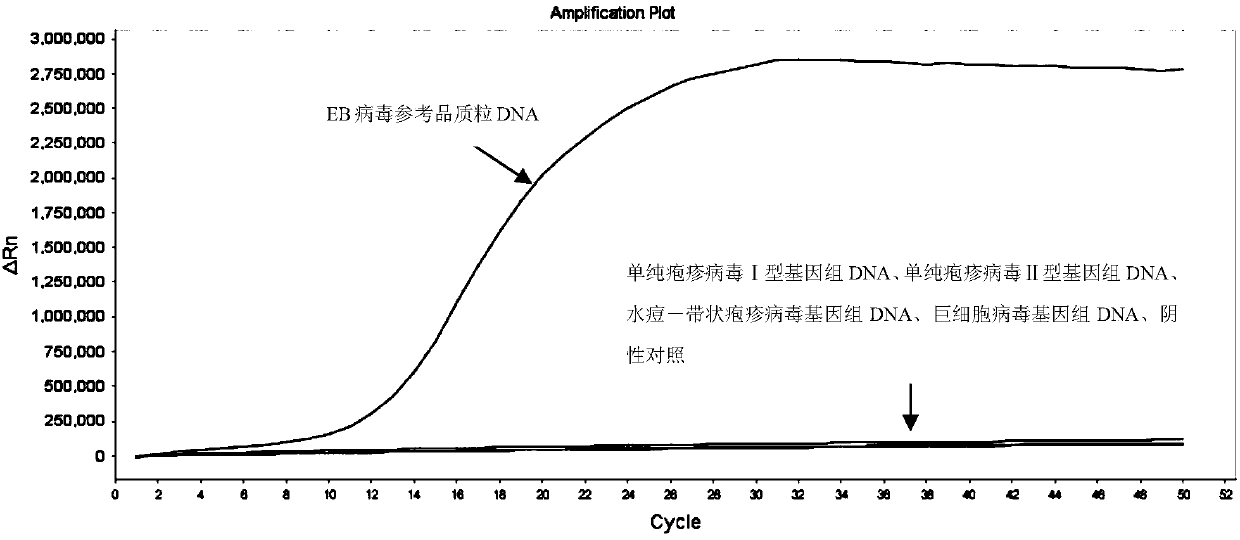 LAMP primers for detecting EB viruses in intraocular fluid and application thereof