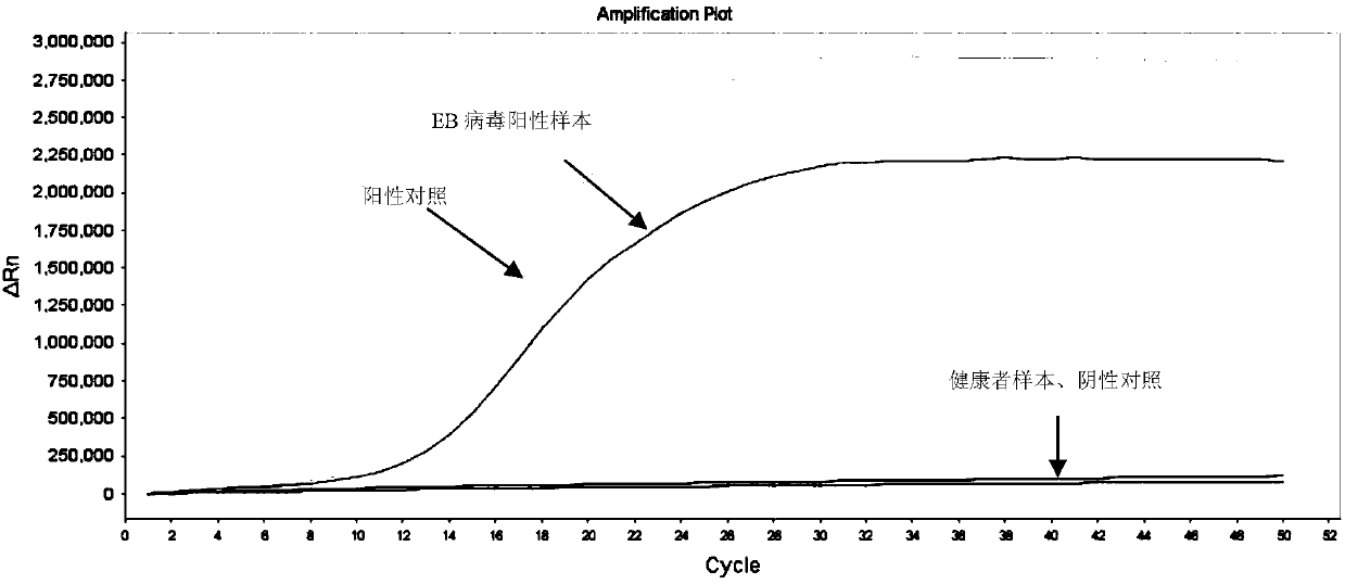 LAMP primers for detecting EB viruses in intraocular fluid and application thereof