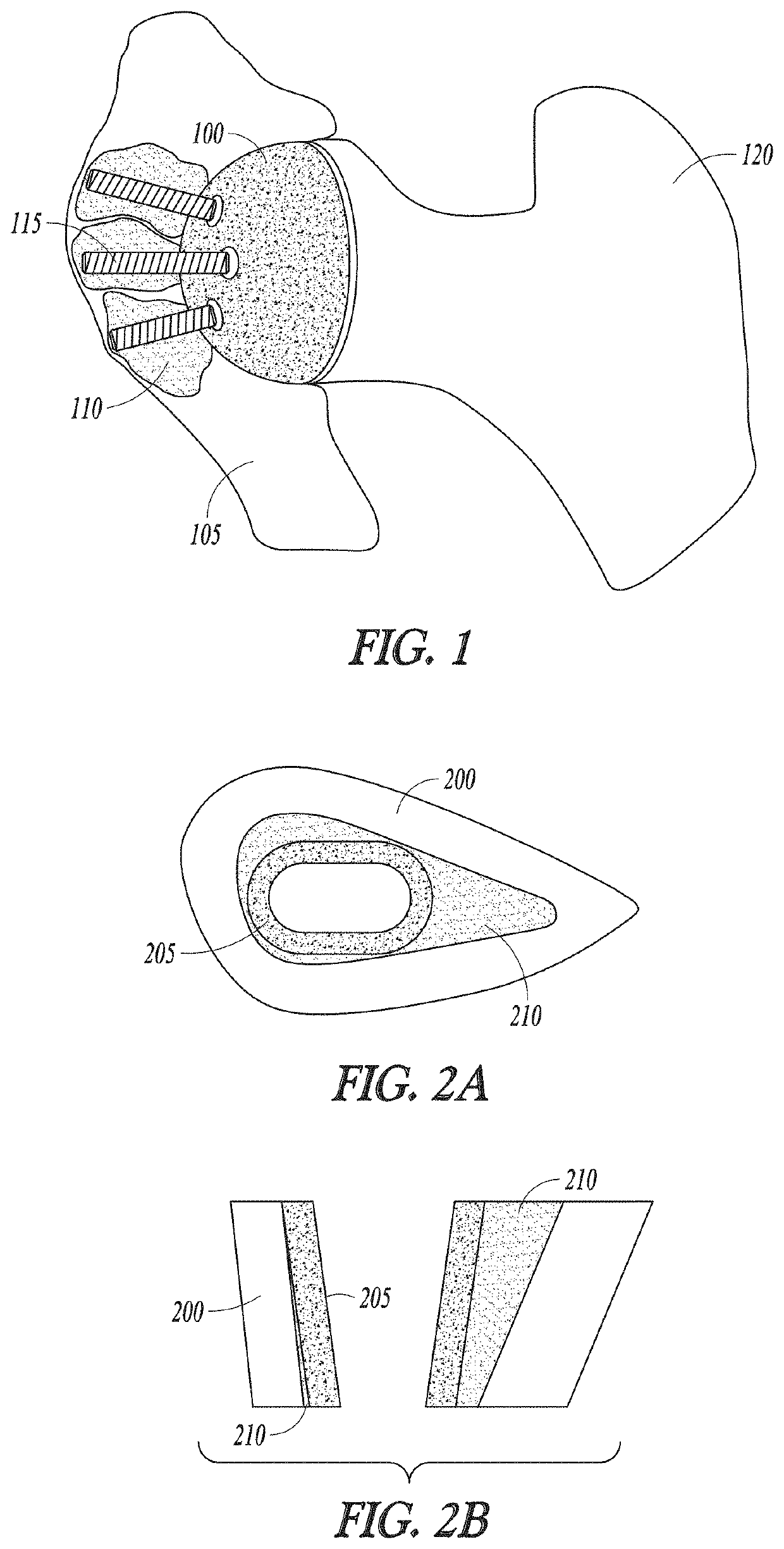 Curable calcium phosphate compositions for use with porous structures and methods of using the same