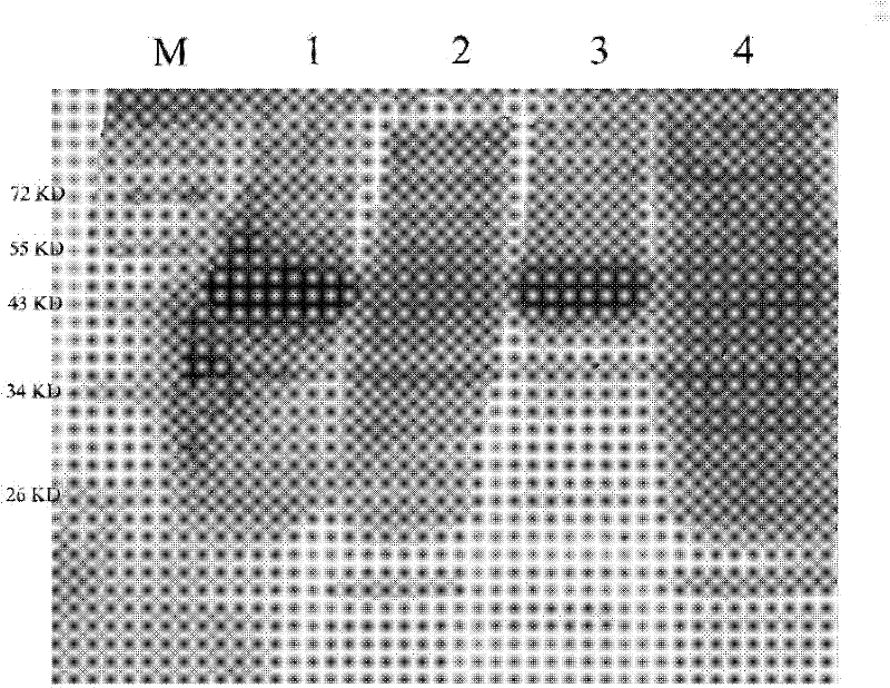 Recombination fusion protein Trx-TAT-hMsrA and application thereof to aspect of nerve cell protection