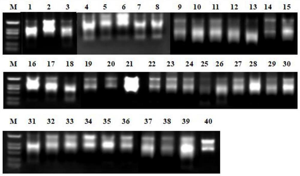 Application of LINC01996 in diagnosis of allergic airway inflammation