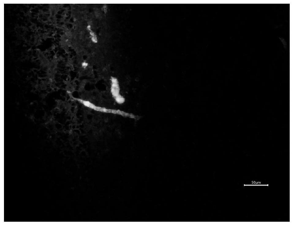 Immunofluorescence kit and application for detection of eggshell precursor protein of flounder flounder