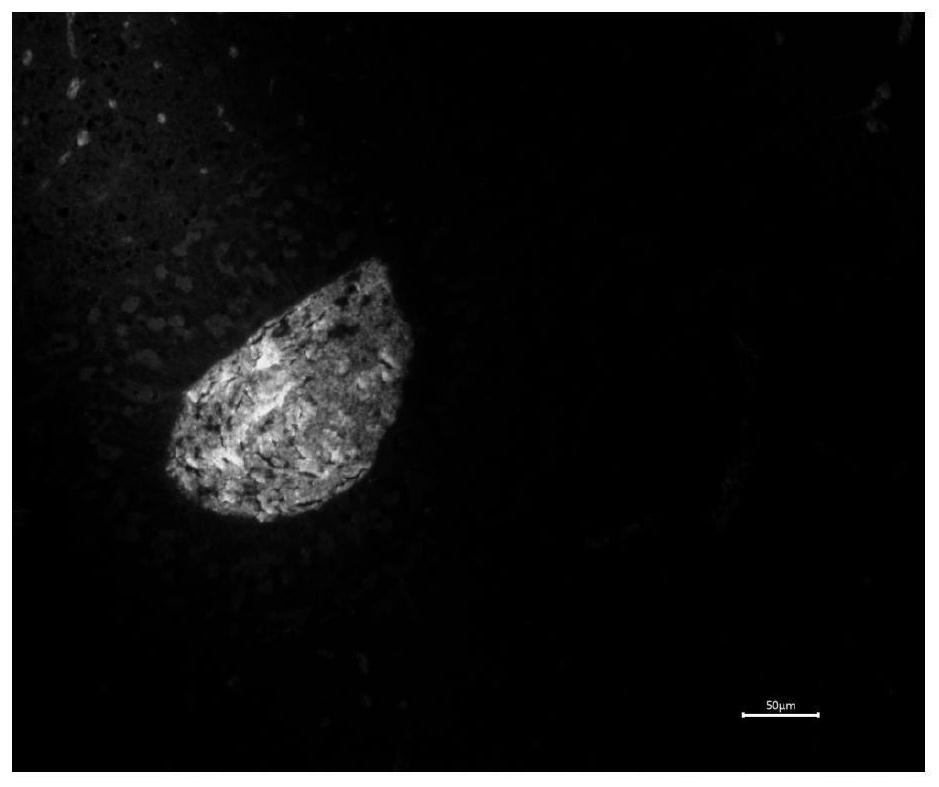 Immunofluorescence kit and application for detection of eggshell precursor protein of flounder flounder