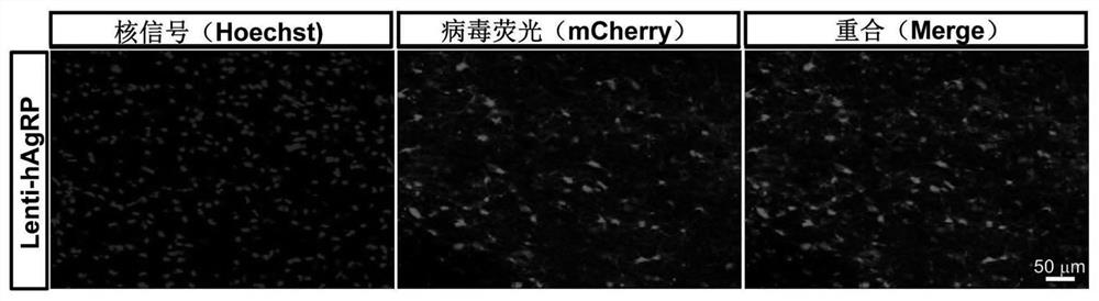 Vectors and reagent for constructing hNPY and hAgRP gene overexpression chimeric animal model and application