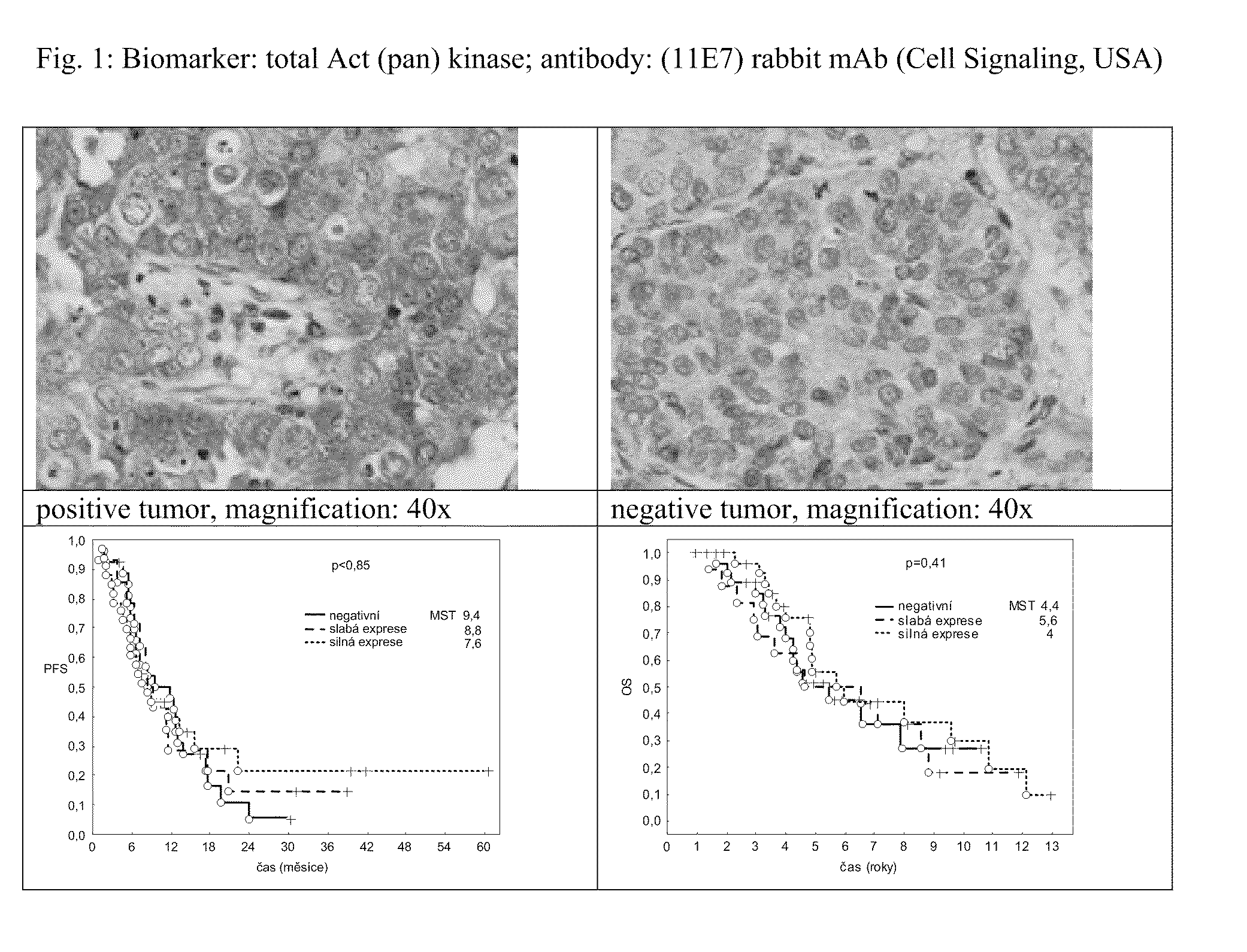 Method For Determining The Sensitivity Of Patients Suffering From A Cancer Disease To Biological Therapy