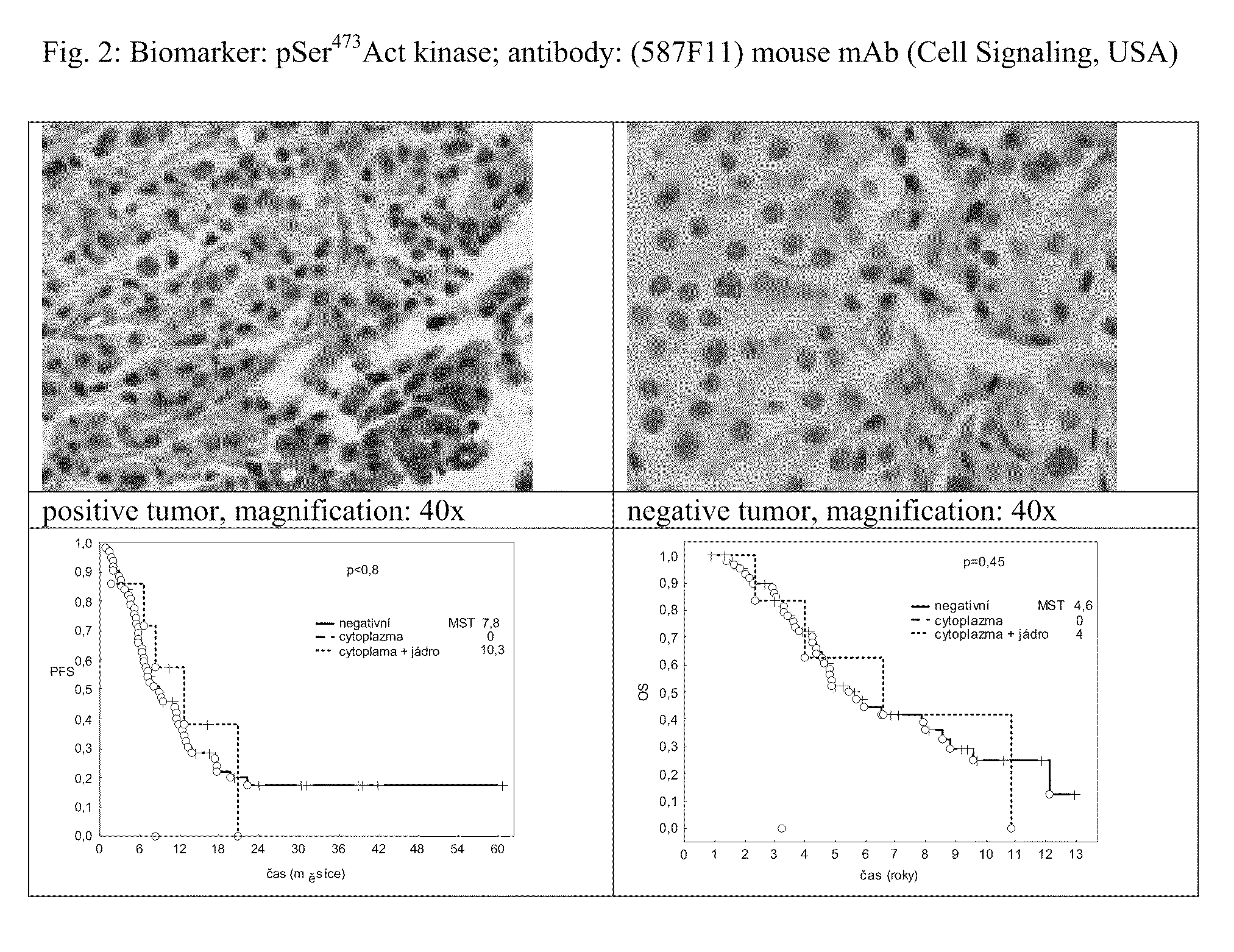 Method For Determining The Sensitivity Of Patients Suffering From A Cancer Disease To Biological Therapy