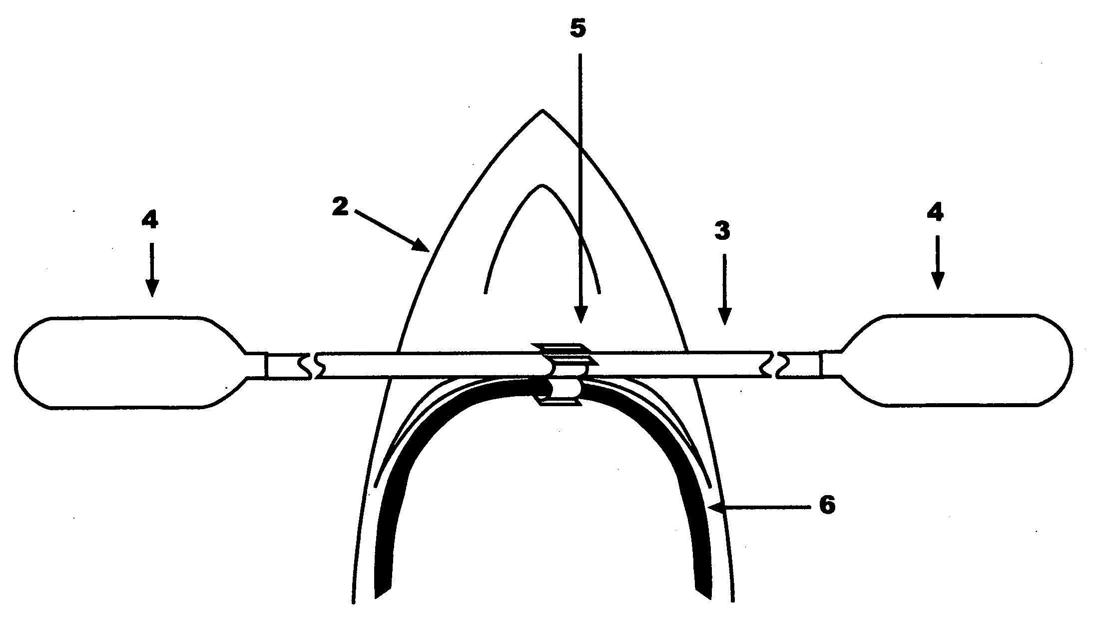 Paddle Clip and method for using same