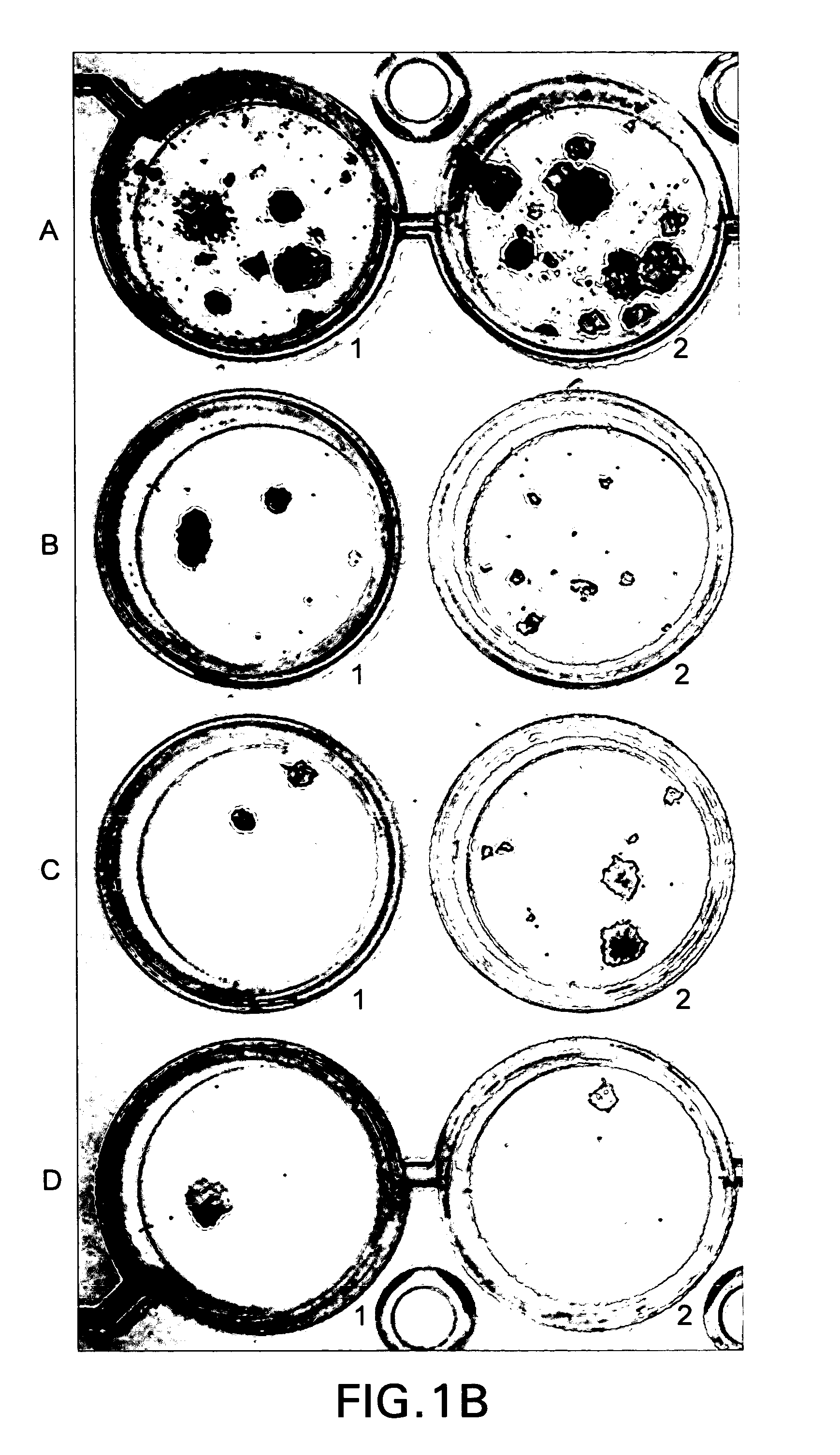 Method for selectively culturing epithelial or carcinoma cells