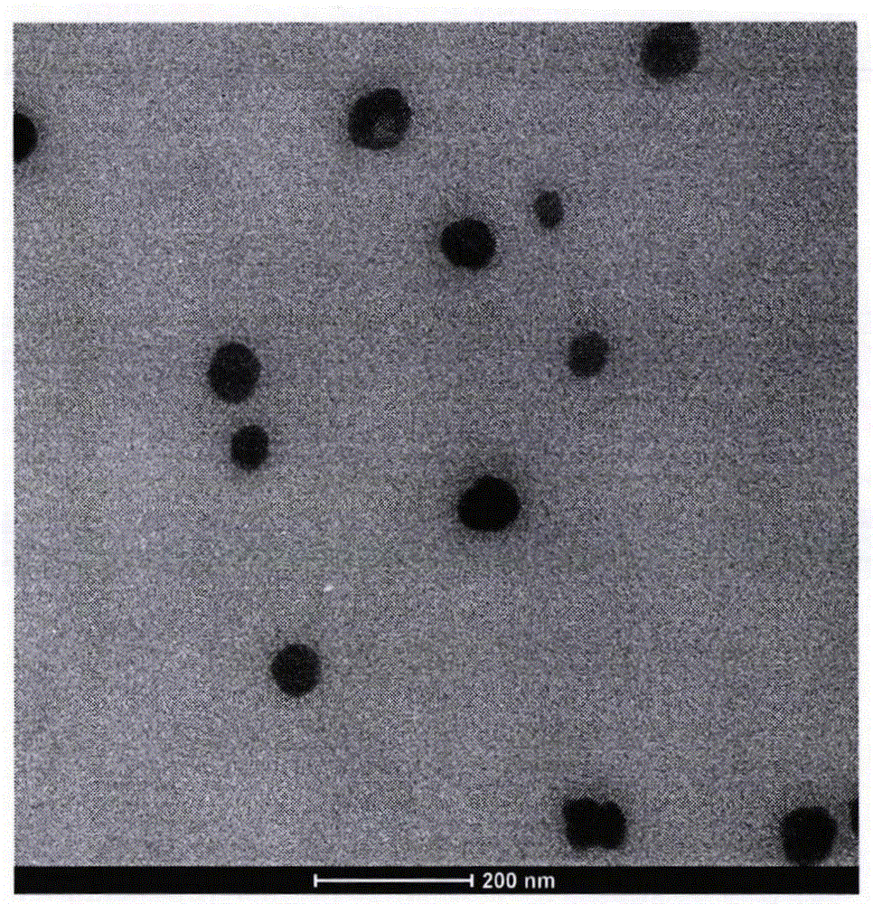 Nano magnetotherapy externally used gel for treating acne vulgaris, and preparation method and application of nano magnetotherapy gel