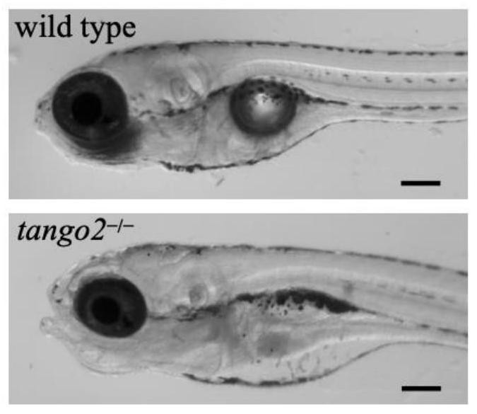 Zebra fish model for metabolic encephalopathy and arrhythmia diseases and application of zebra fish model
