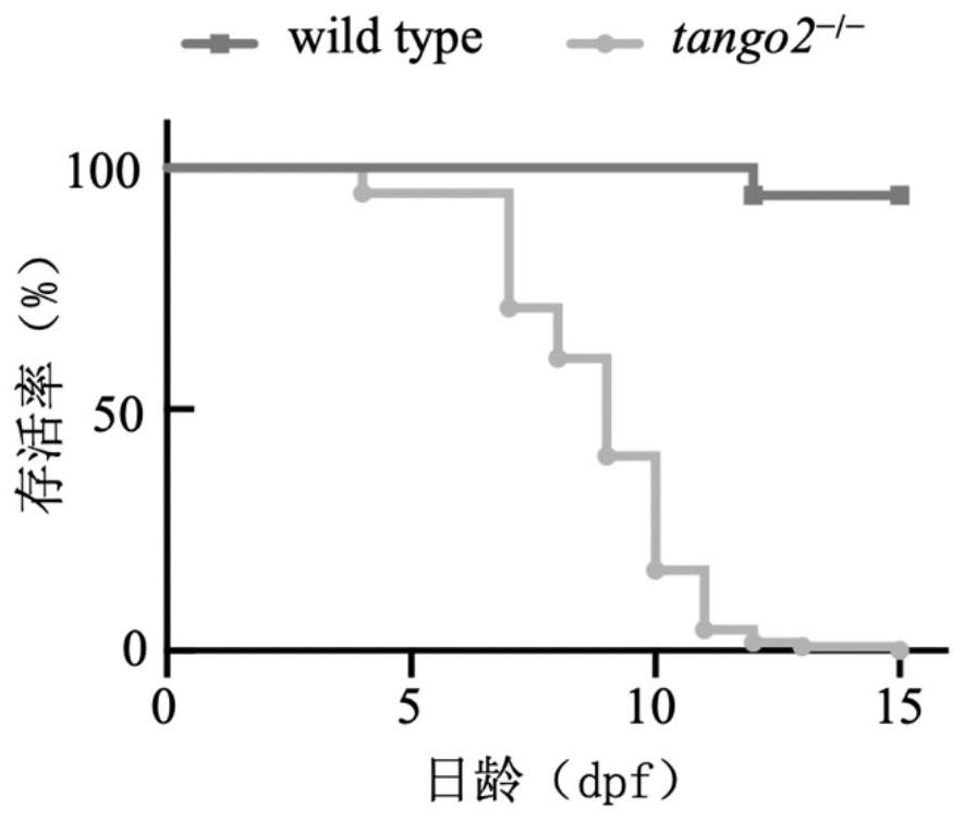 Zebra fish model for metabolic encephalopathy and arrhythmia diseases and application of zebra fish model