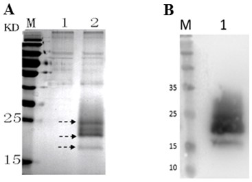 Pseudosciaena crocea Cystatin recombinant protein and application thereof