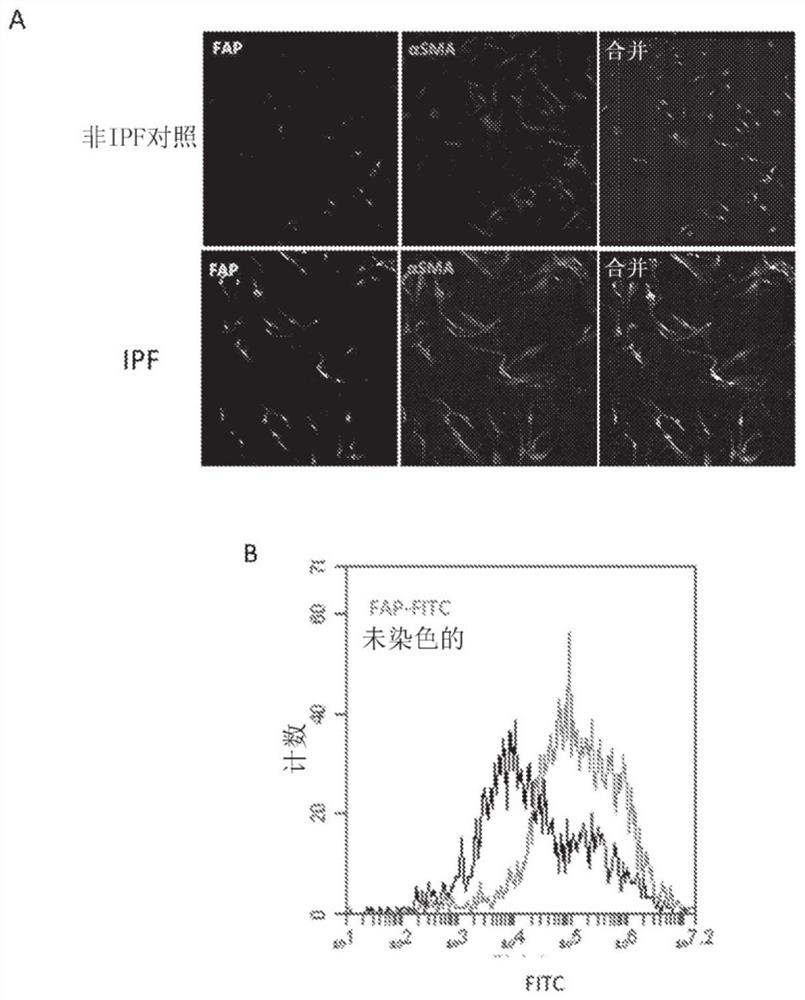 Fibroblast activation protein (FAP) targeted imaging and therapy in fibrosis