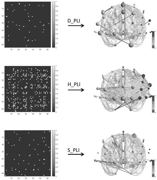 Depression and bipolar disorder brain network analysis method based on dual-channel phase synchronization feature fusion