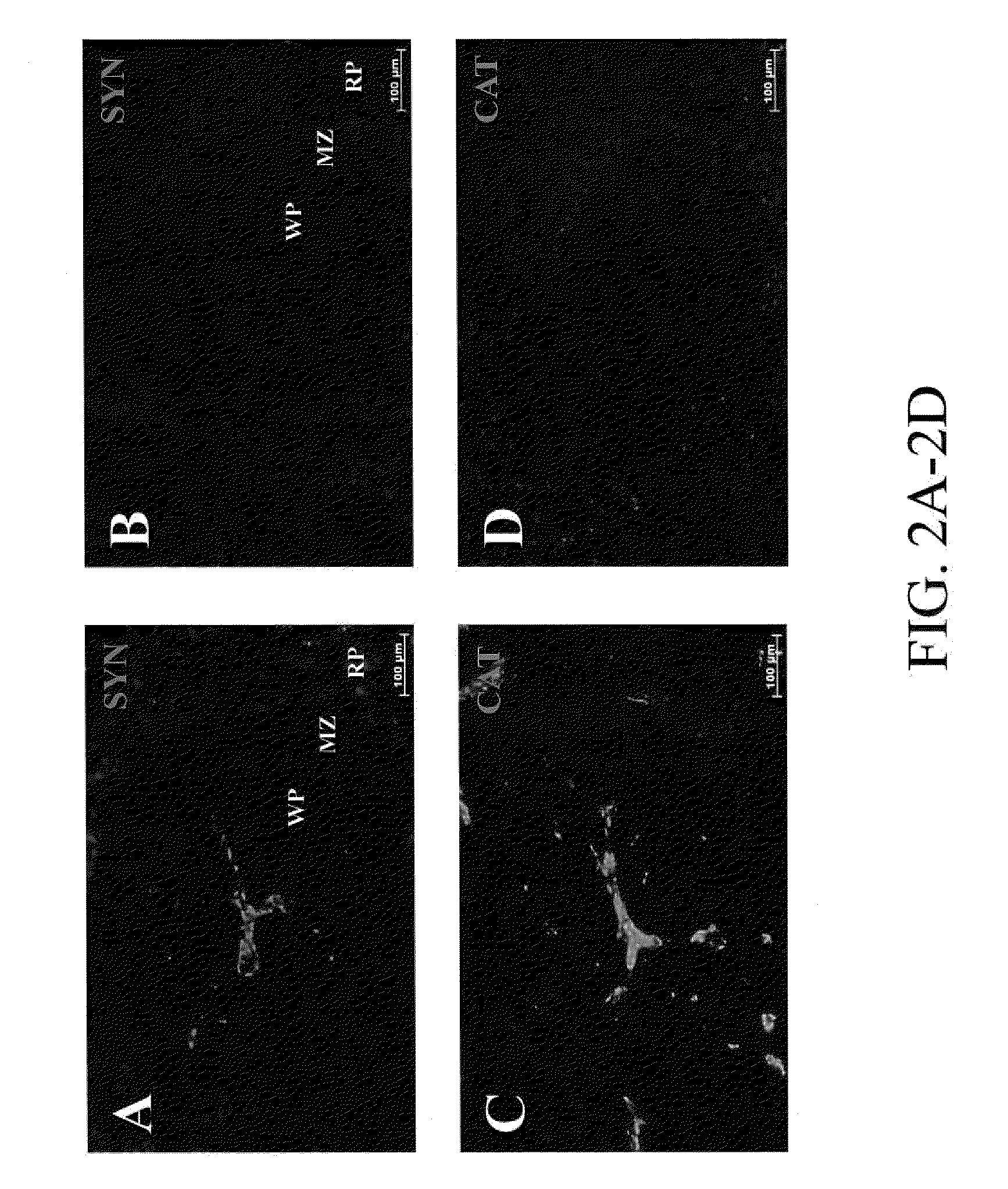 Methods and systems for reducing inflammation by neuromodulation of t-cell activity