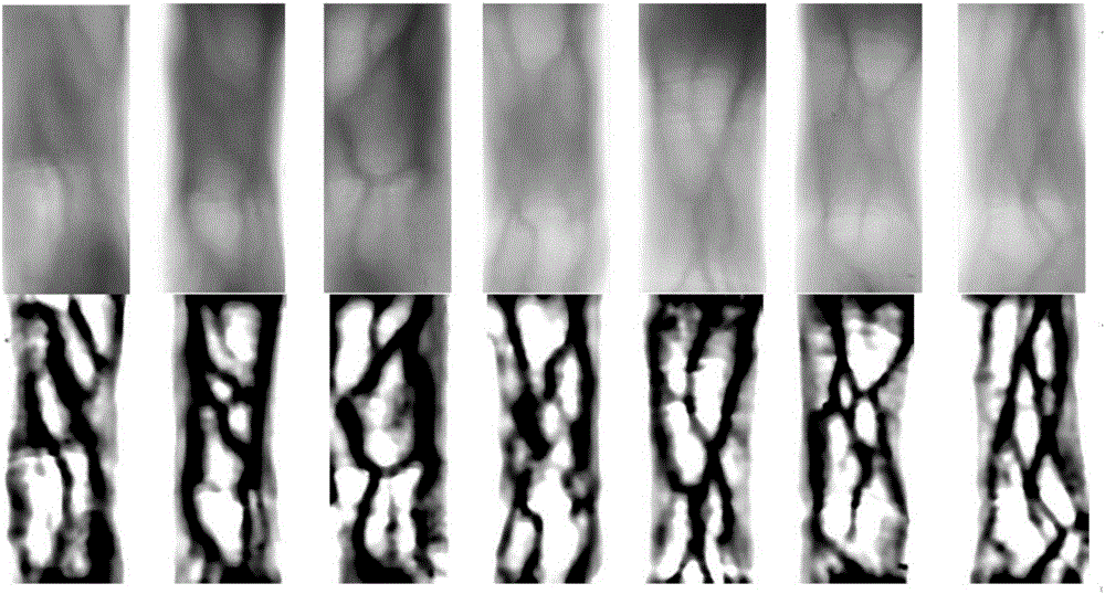 Adaptive guided filtering-based digital vein image enhancement method