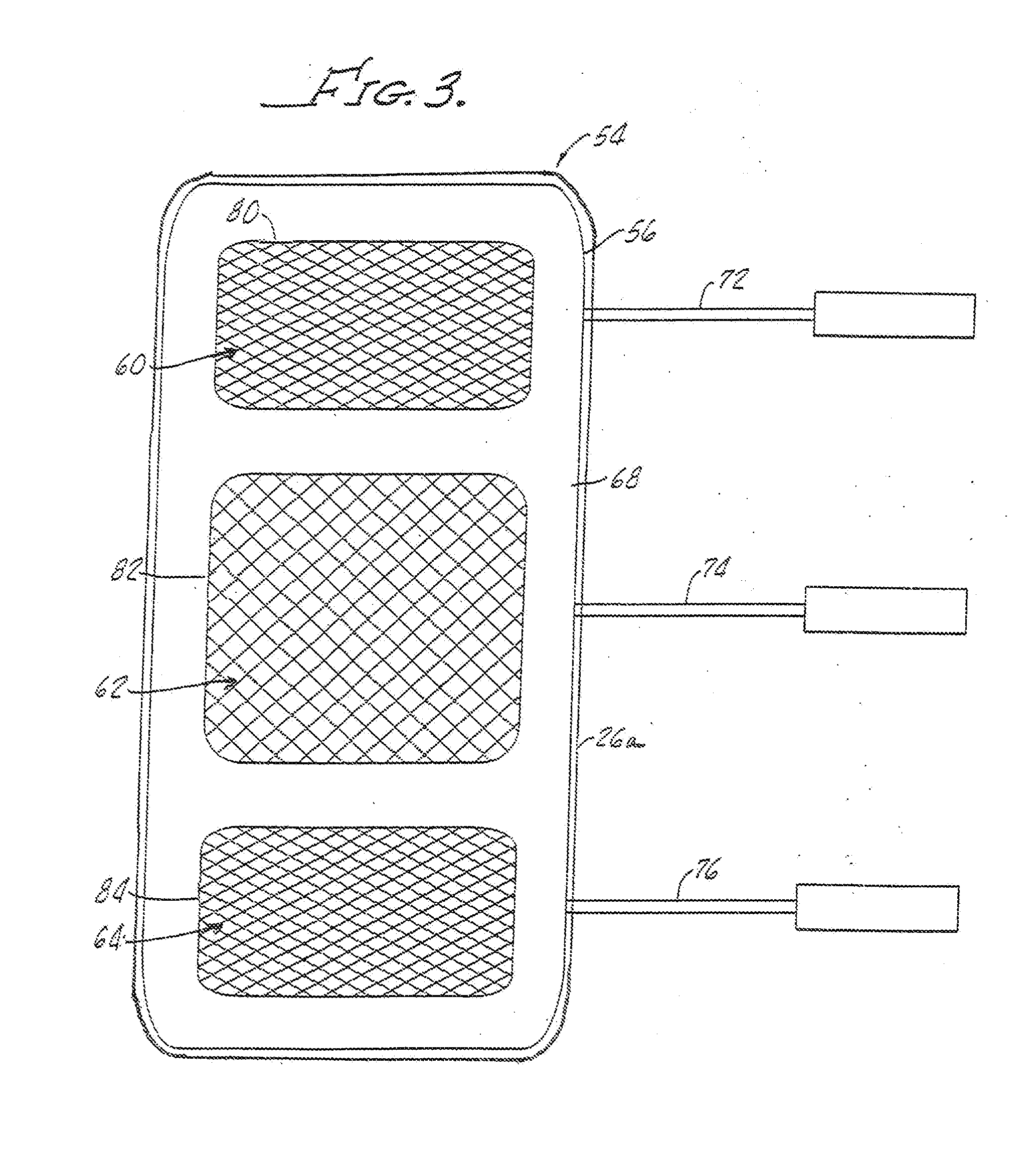 Multi-electrode with lateral conductivity control