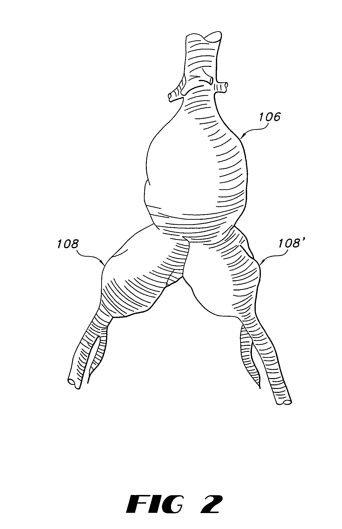 Endovascular prostethic devices having hook and loop structures