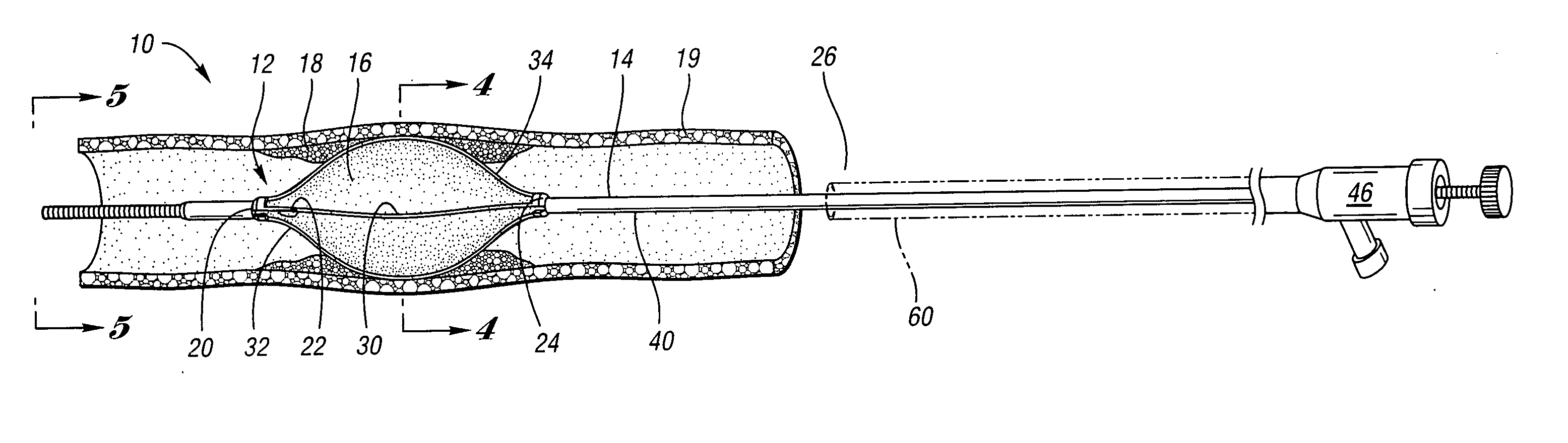 Angioplasty cutting device and method for treating a stenotic lesion in a body vessel