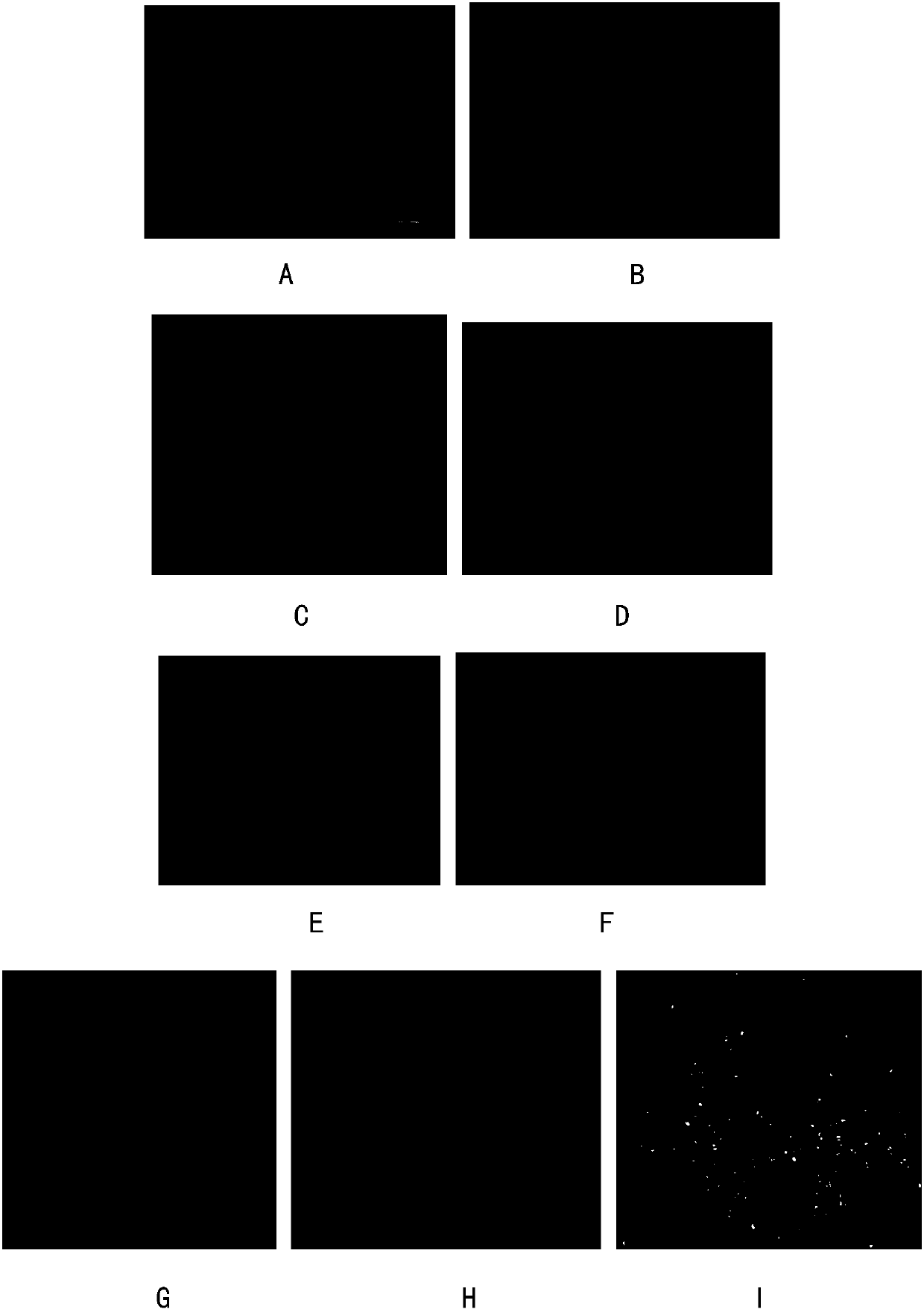 Preparation method of immunohistochemical detecting section