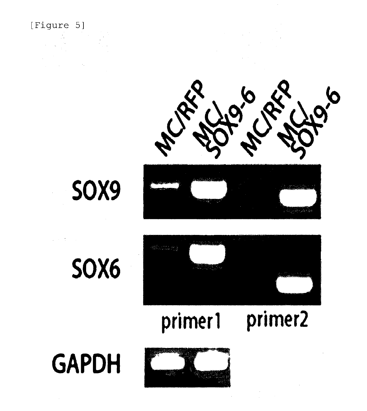 Nonviral minicircle vector carrying sox gene and construction method therefor