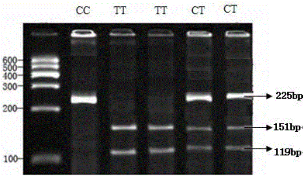 SNP locus of chicken NRAMP1 gene and obtaining method and application thereof