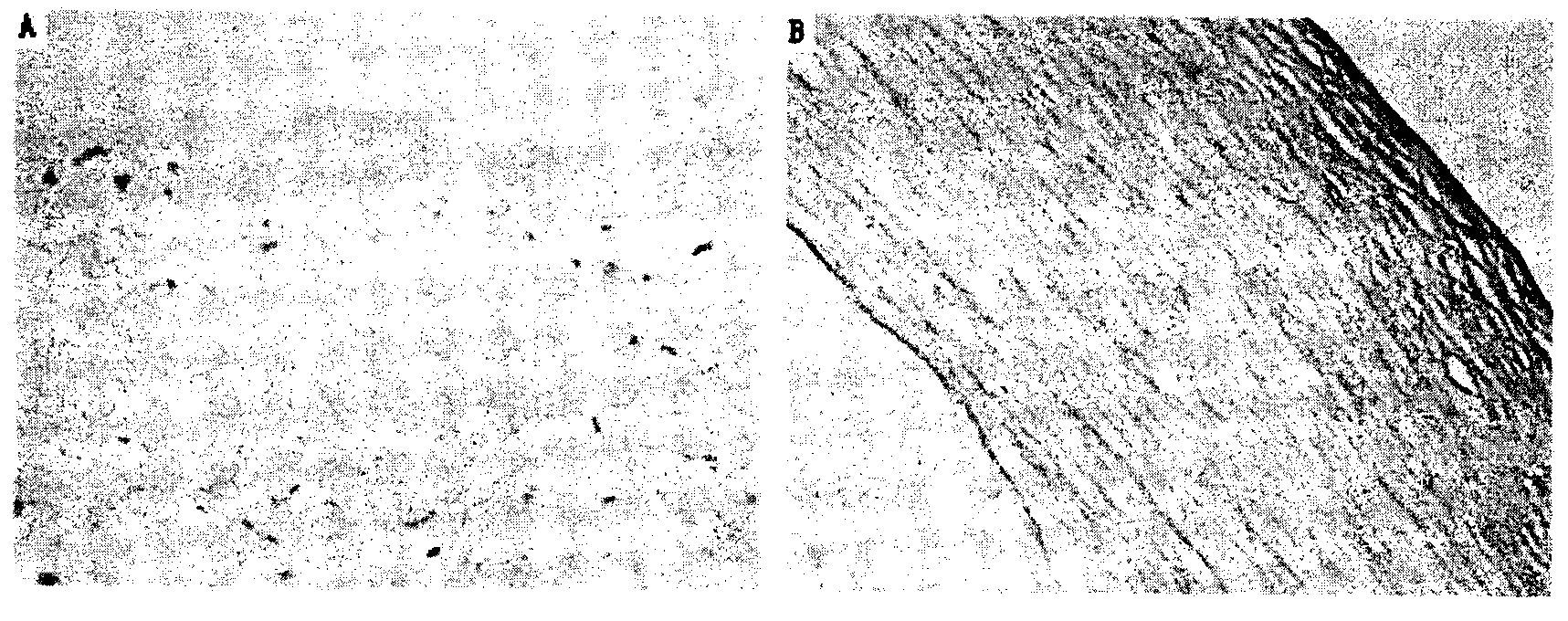 Method for preparing cornea lamina material