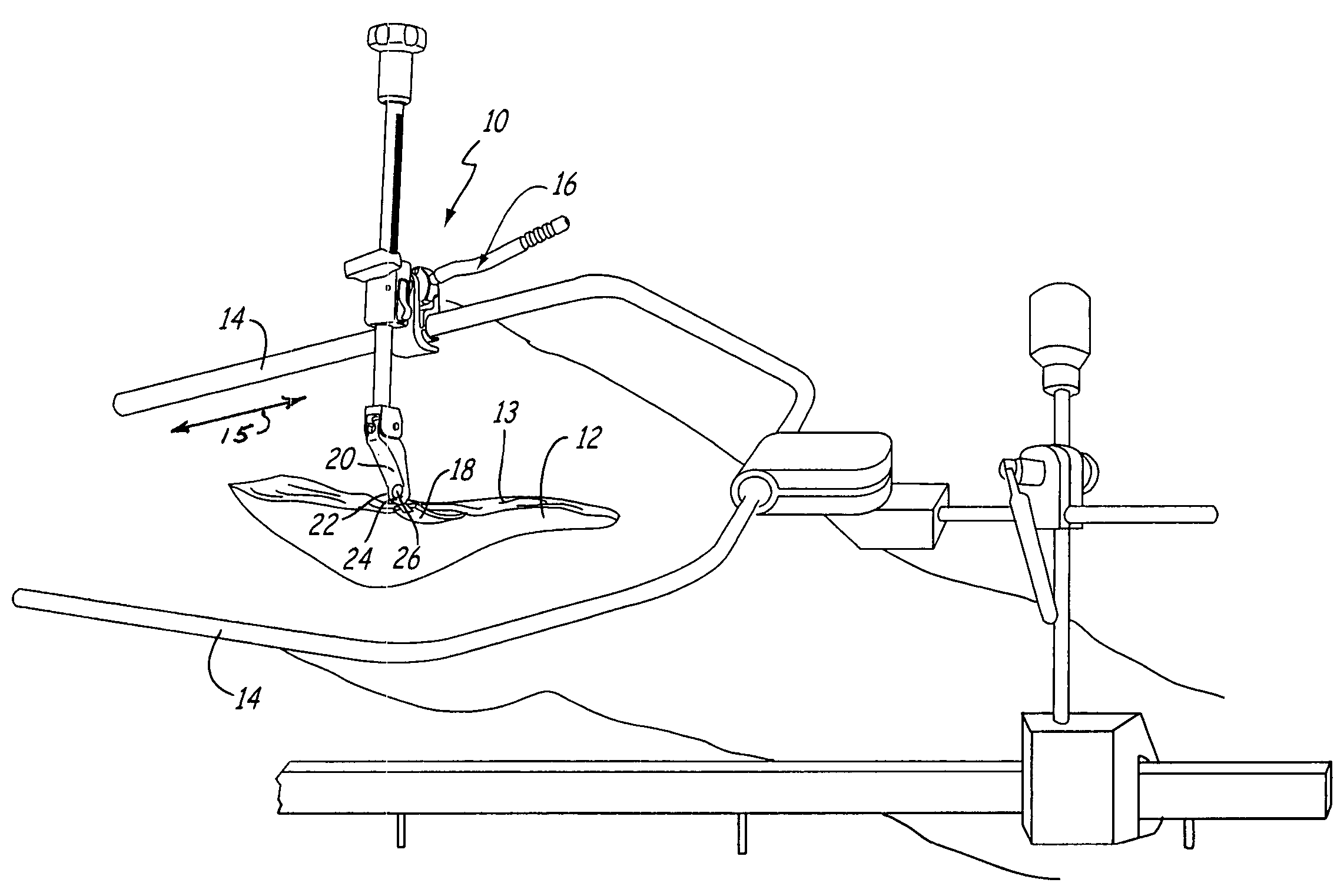 Articulated retractor blade holder