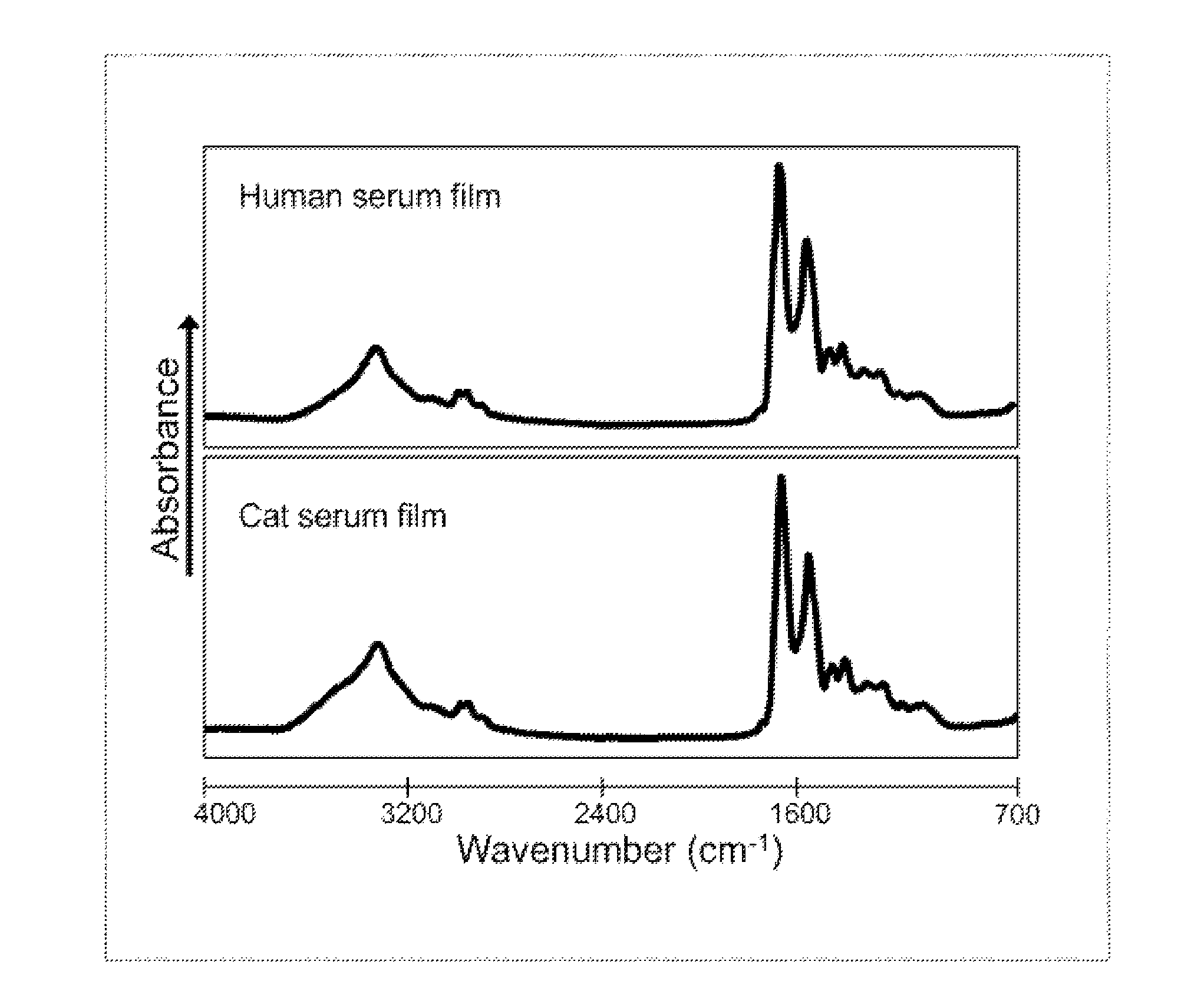 Rapid diagnosis of a disease condition using infrared spectroscopy