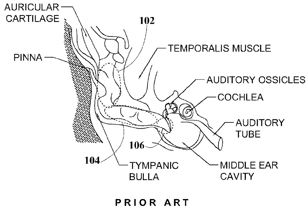 Pharmaceutical Compositions for Treating Ear Diseases