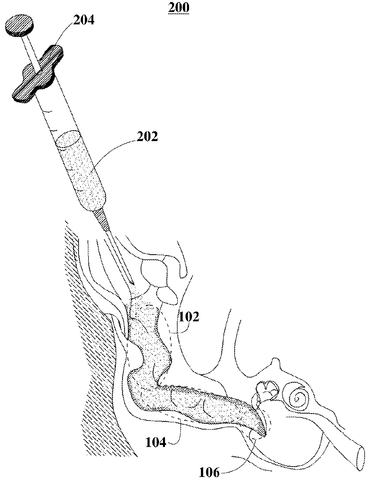 Pharmaceutical Compositions for Treating Ear Diseases